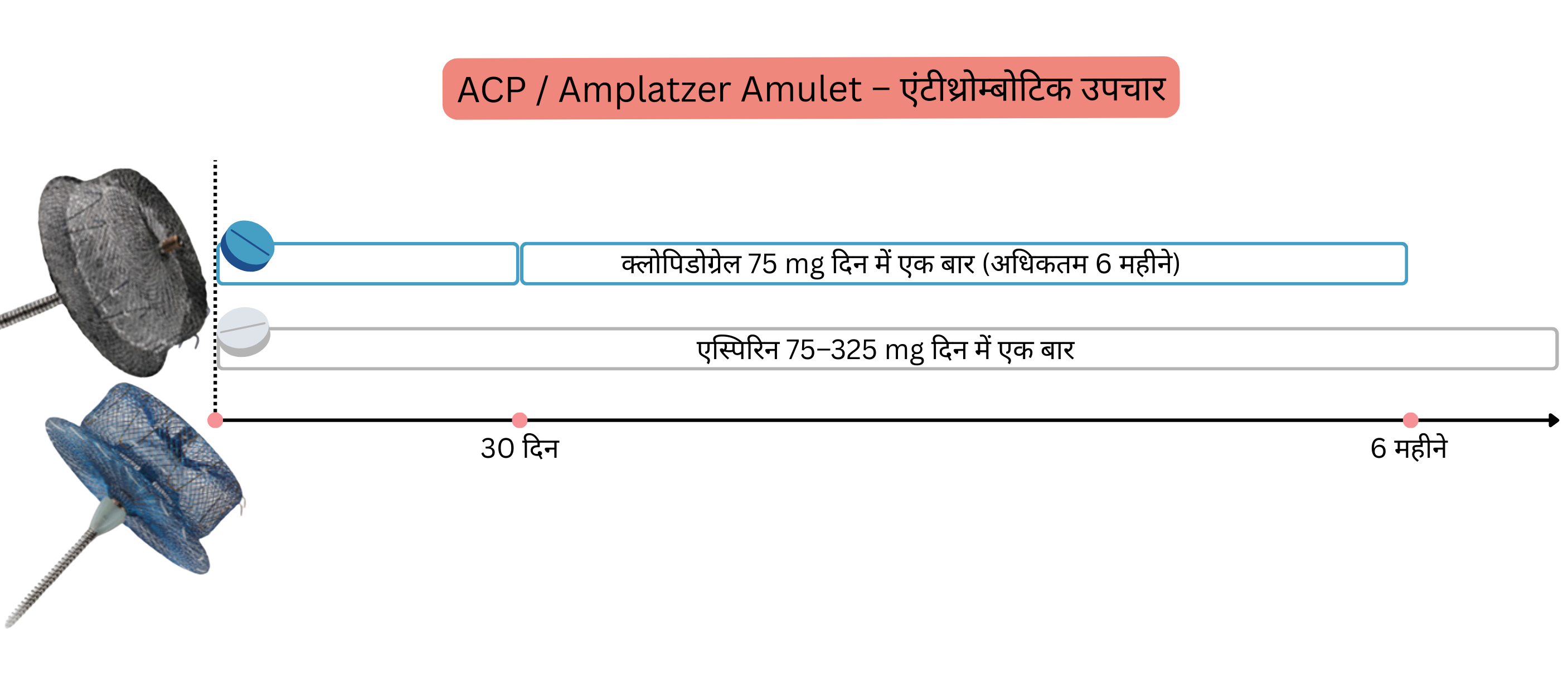 चित्र में ACP और Amplatzer Amulet उपकरणों के प्रत्यारोपण के बाद एंटीथ्रोम्बोटिक उपचार को दर्शाया गया है, जिसमें 6 माह तक की निर्धारित अवधि में क्लोपिडोग्रेल और एस्पिरिन का उपयोग शामिल है।