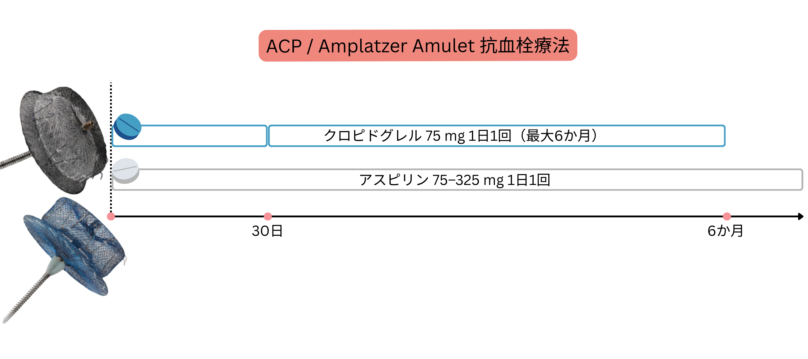 ACPおよびAmplatzer Amuletデバイス植込み後の抗血栓療法を示す模式図で、最長6か月の一定期間にクロピドグレルとアスピリンを投与する戦略を示している。
