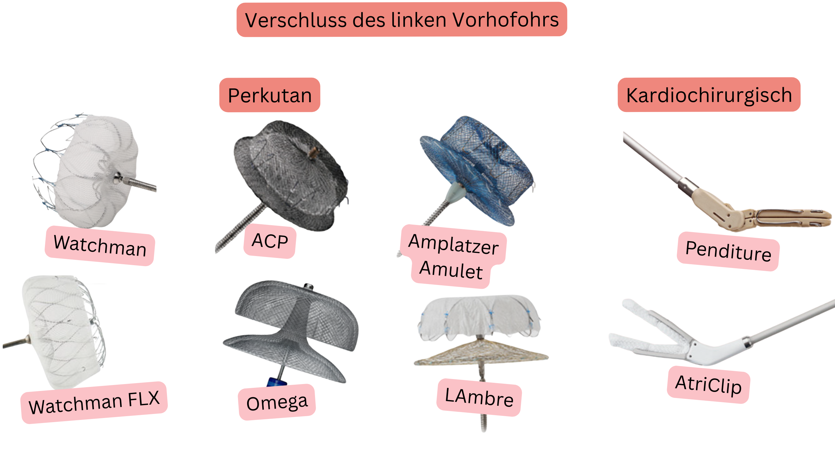 Abbildung zur Darstellung des Verschlusses des linken Vorhofohrs mit perkutanen Systemen Watchman, Watchman FLX, ACP, Amplatzer Amulet, LAMBRE und Omega sowie kardiochirurgischen Systemen AtriClip und PendiTure zur Thromboembolieprävention bei Patienten mit Vorhofflimmern.