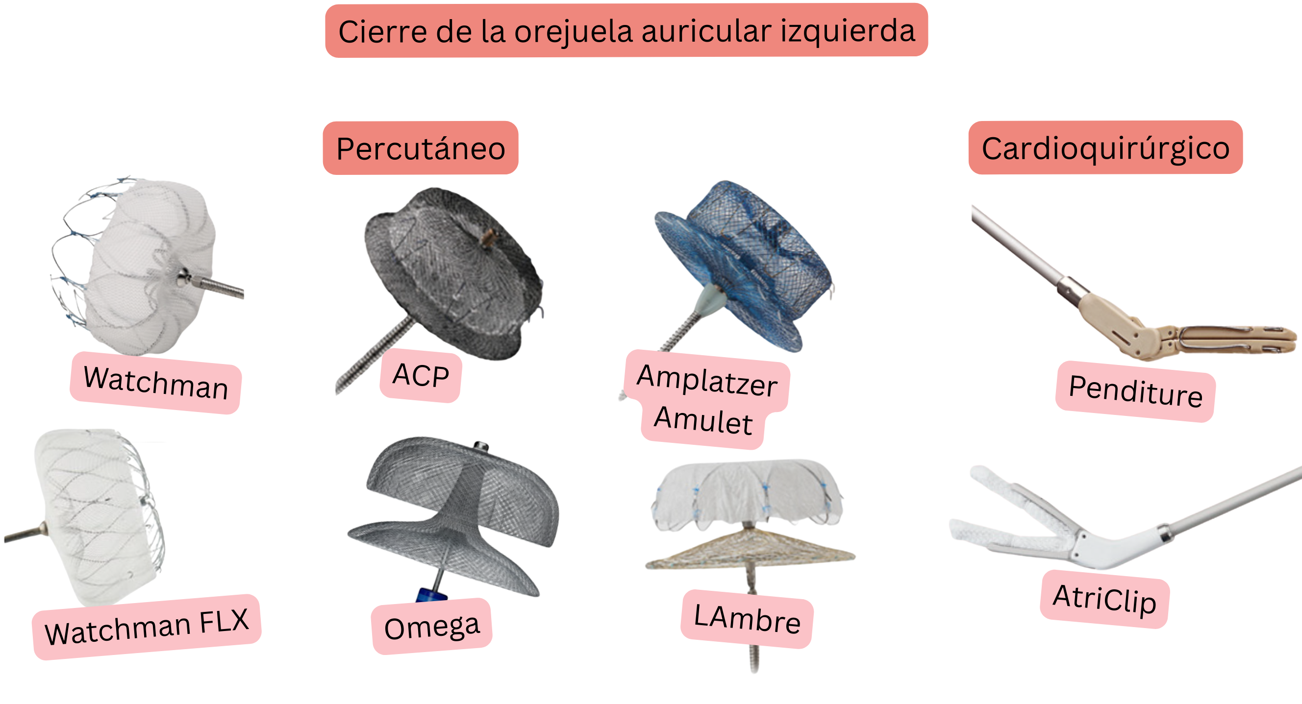 Ilustración que muestra el cierre de la orejuela auricular izquierda mediante dispositivos percutáneos Watchman, Watchman FLX, ACP, Amplatzer Amulet, LAMBRE y Omega, y sistemas quirúrgicos AtriClip y PendiTure, para la prevención del tromboembolismo en pacientes con fibrilación auricular.