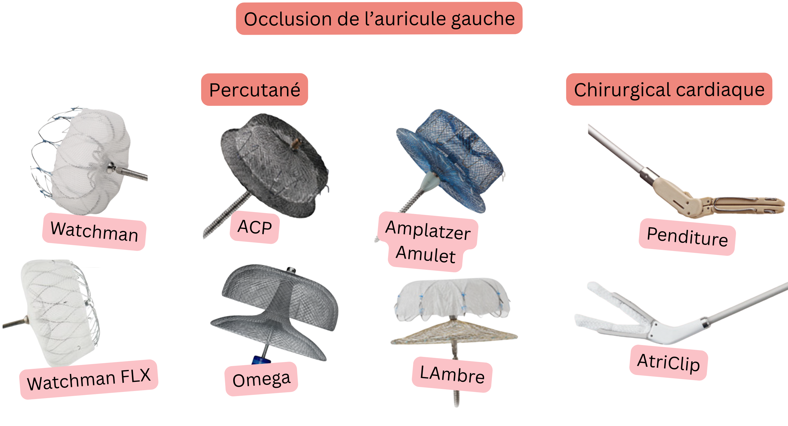 Illustration représentant l’occlusion de l’auricule gauche à l’aide de dispositifs percutanés Watchman, Watchman FLX, ACP, Amplatzer Amulet, LAMBRE et Omega, ainsi que des systèmes chirurgicaux AtriClip et PendiTure, pour la prévention du thromboembolisme chez les patients atteints de fibrillation atriale.