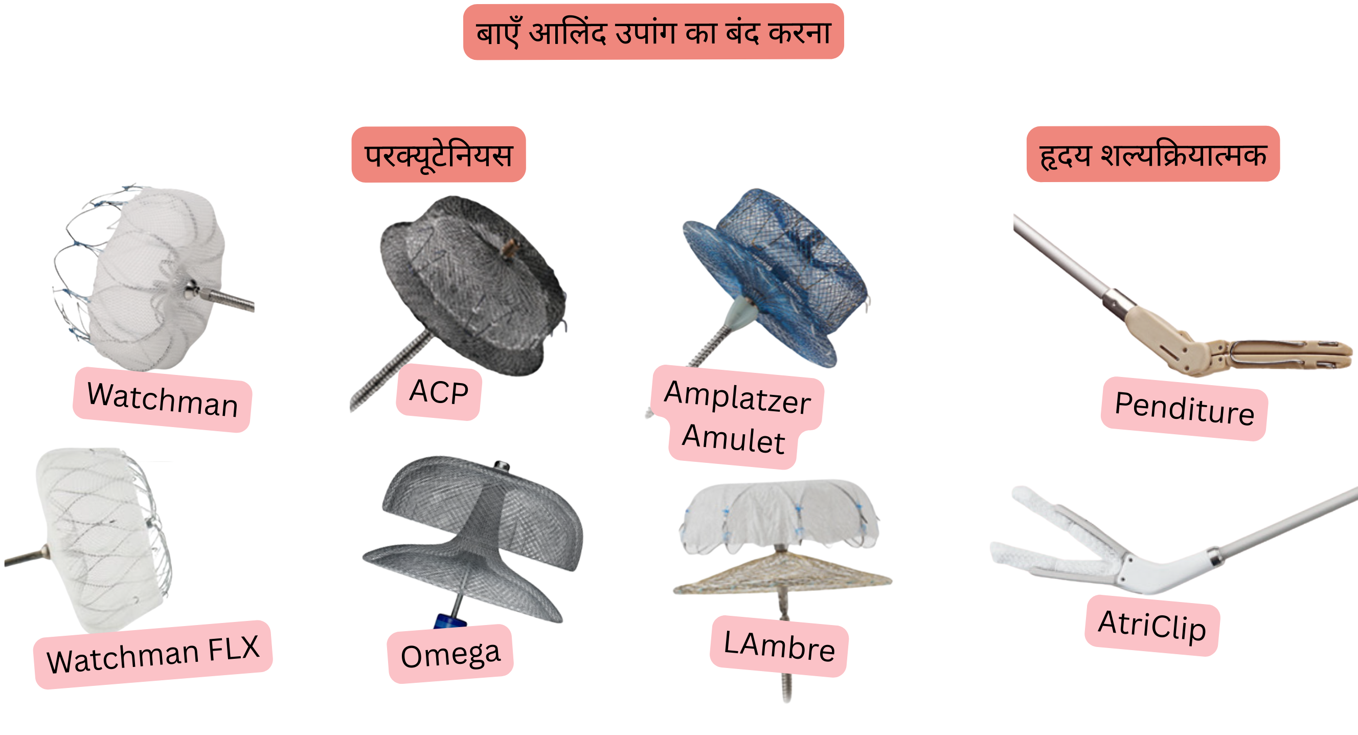 चित्र में एट्रियल फिब्रिलेशन रोगियों में थ्रोम्बोएम्बोलिज़्म की रोकथाम हेतु परक्यूटेनियस उपकरण Watchman, Watchman FLX, ACP, Amplatzer Amulet, LAMBRE और Omega तथा कार्डियक सर्जिकल सिस्टम AtriClip और PendiTure द्वारा बाएँ एट्रियल एपेंडेज क्लोज़र को दर्शाया गया है।
