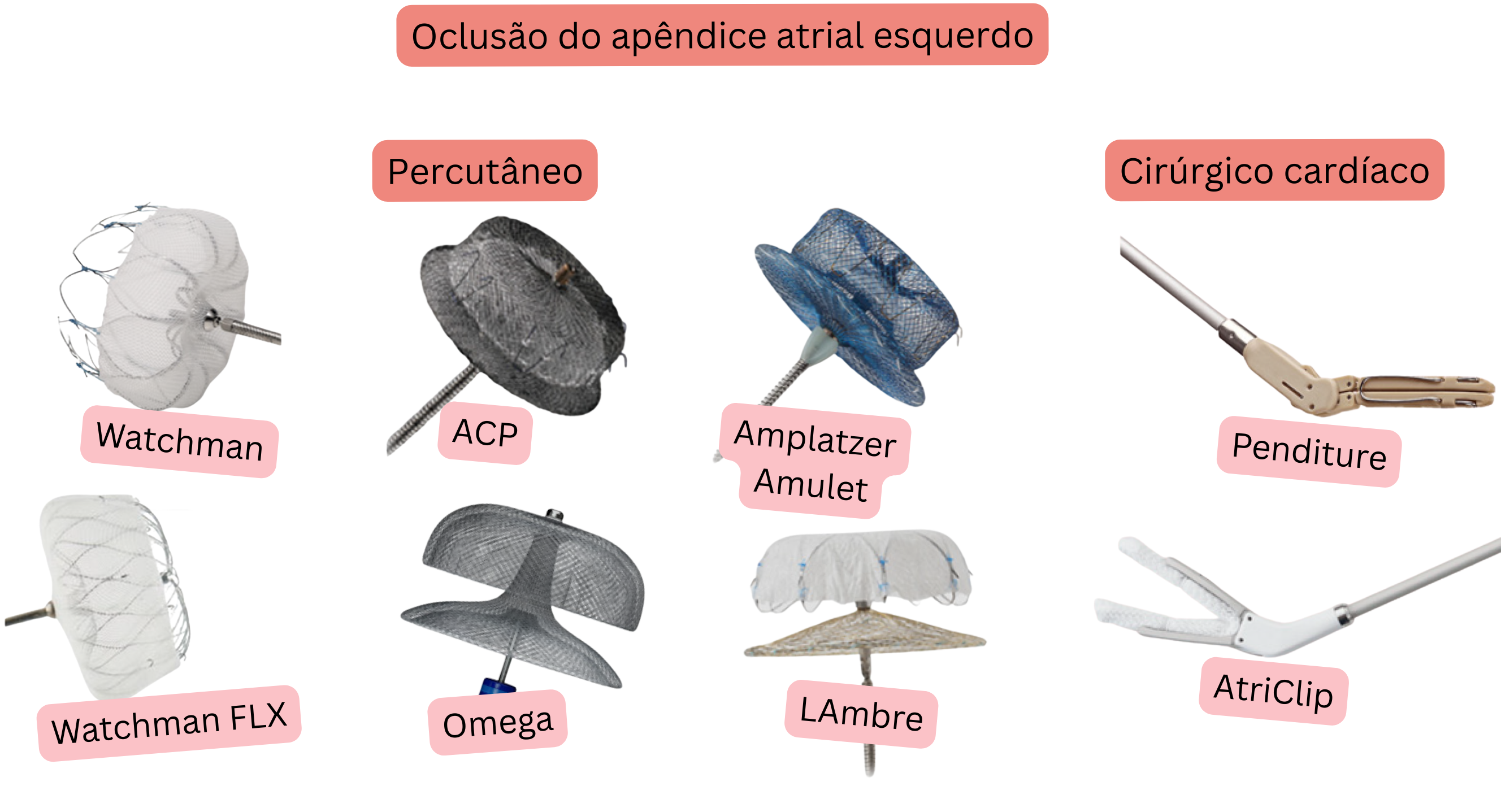 Ilustração que demonstra o encerramento do apêndice auricular esquerdo com dispositivos percutâneos Watchman, Watchman FLX, ACP, Amplatzer Amulet, LAMBRE e Omega, bem como sistemas cirúrgicos AtriClip e PendiTure, na prevenção do tromboembolismo em doentes com fibrilação atrial.
