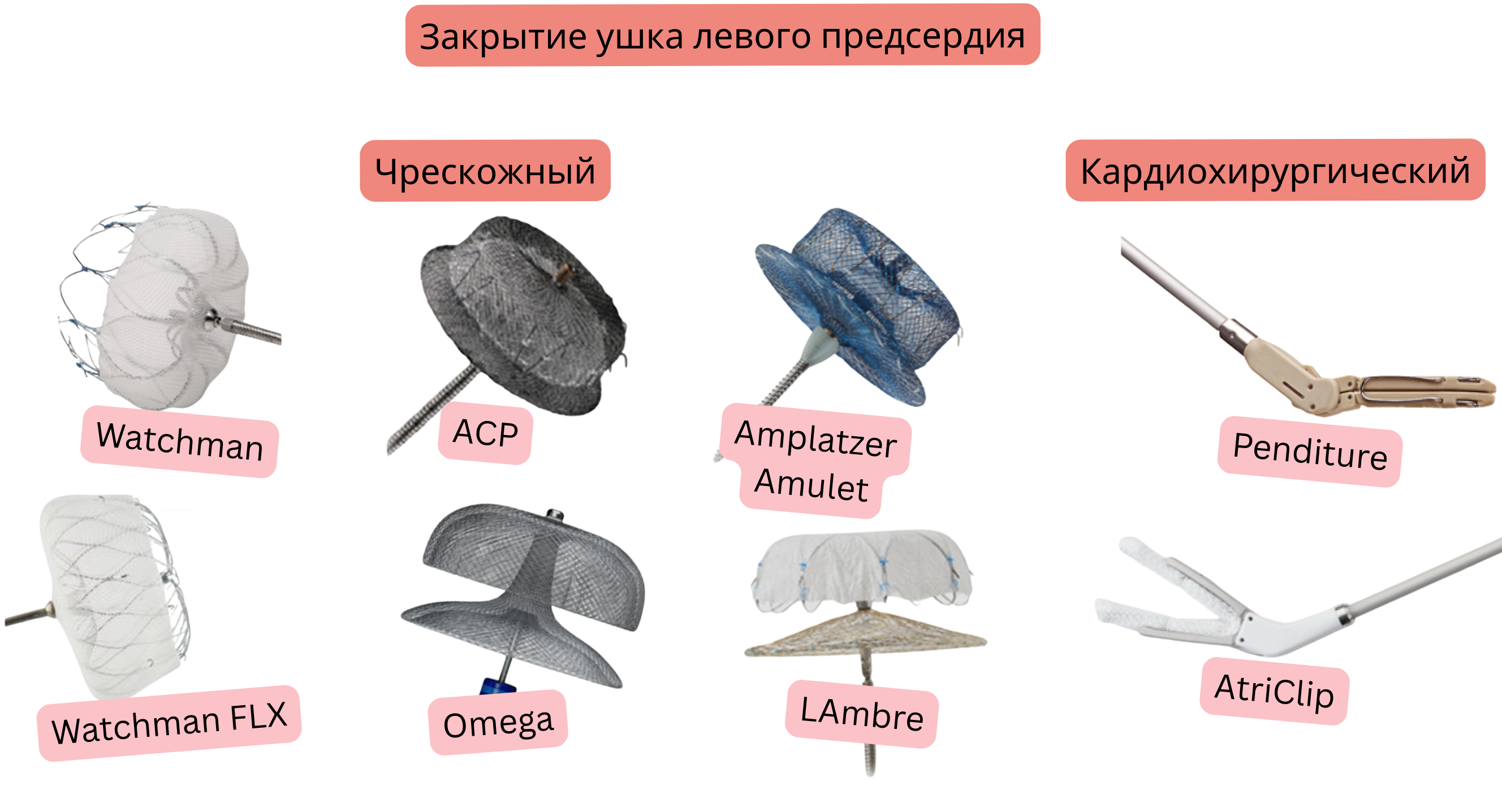 Иллюстрация, демонстрирующая закрытие ушка левого предсердия с помощью чрескожных устройств Watchman, Watchman FLX, ACP, Amplatzer Amulet, LAMBRE и Omega, а также кардиохирургических систем AtriClip и PendiTure для профилактики тромбоэмболии у пациентов с фибрилляцией предсердий.