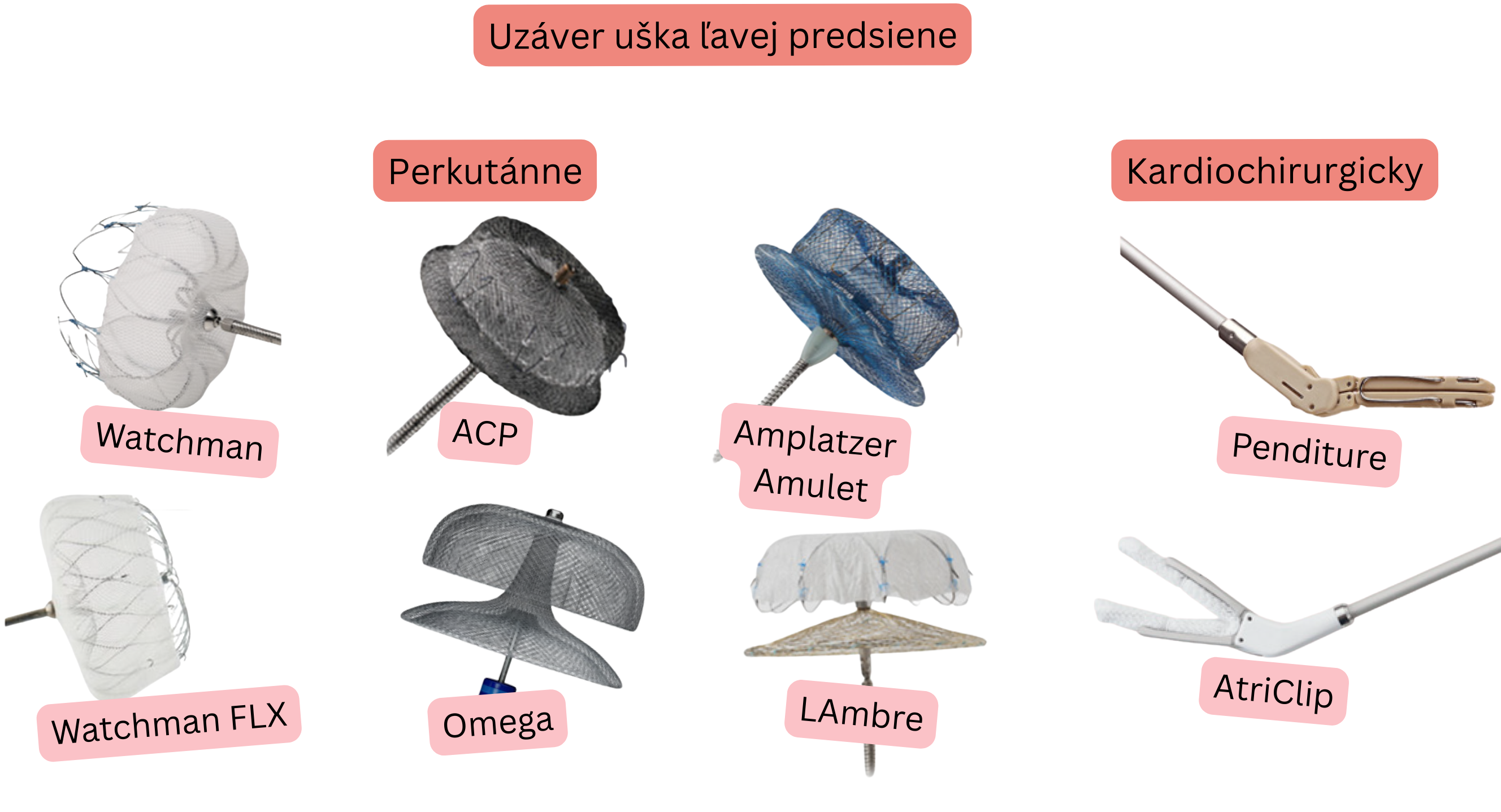 Ilustrácia znázorňujúca uzáver uška ľavej predsiene pomocou perkutánnych zariadení Watchman, Watchman FLX, ACP, Amplatzer Amulet, LAMBRE a Omega a kardiochirurgických systémov AtriClip a PendiTure pri prevencii tromboembolizmu u pacientov s fibriláciou predsiení.