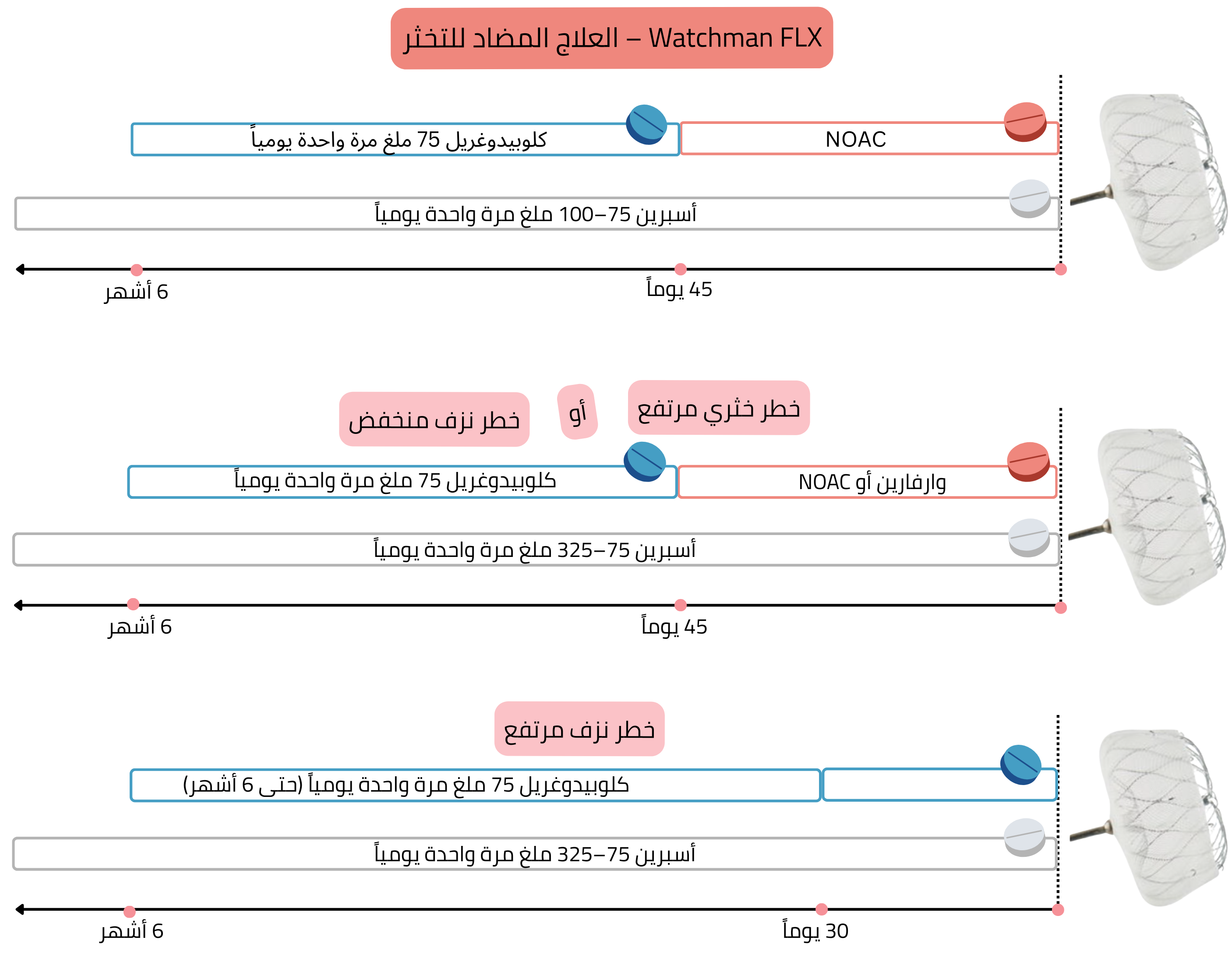 مخطط يوضح العلاج المضاد للتخثر بعد زرع جهاز Watchman FLX، بما في ذلك استراتيجيات استخدام مضادات توثر فموية حديثة، الوارفارين، الكلوبيدوغريل والأسبرين وفقاً لمخاطر النزف والخثار خلال فترة تصل إلى 6 أشهر.