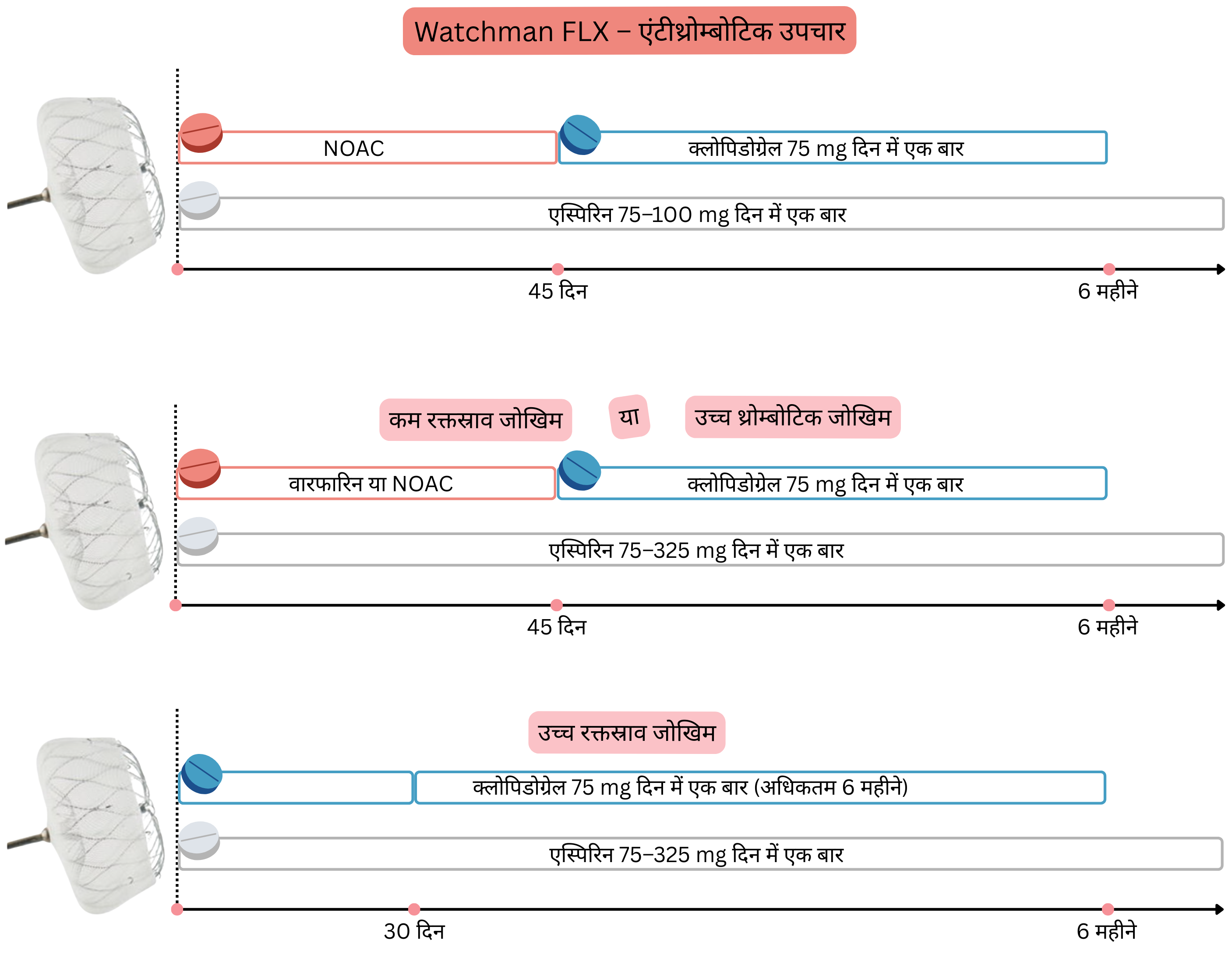 चित्र में Watchman FLX प्रत्यारोपण के बाद एंटीथ्रोम्बोटिक उपचार को दर्शाया गया है, जिसमें 6 माह की अवधि में रक्तस्राव और थ्रोम्बोटिक जोखिम के अनुसार NOAC, वारफारिन, क्लोपिडोग्रेल और एस्पिरिन की रणनीतियाँ शामिल हैं।