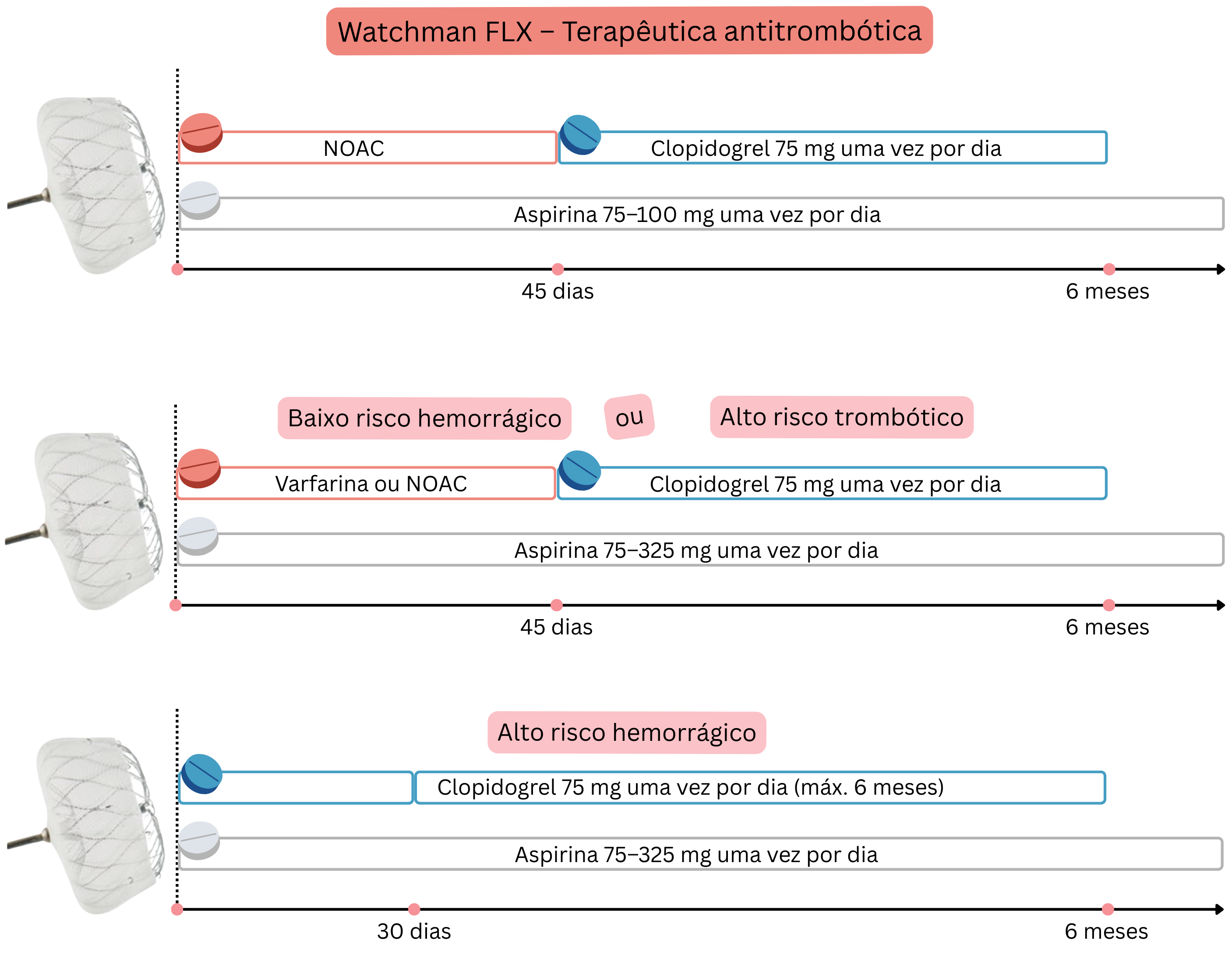 Esquema que ilustra a terapêutica antitrombótica após a implantação do Watchman FLX, incluindo estratégias com NOAC, varfarina, clopidogrel e aspirina de acordo com o risco hemorrágico e trombótico num horizonte até 6 meses.