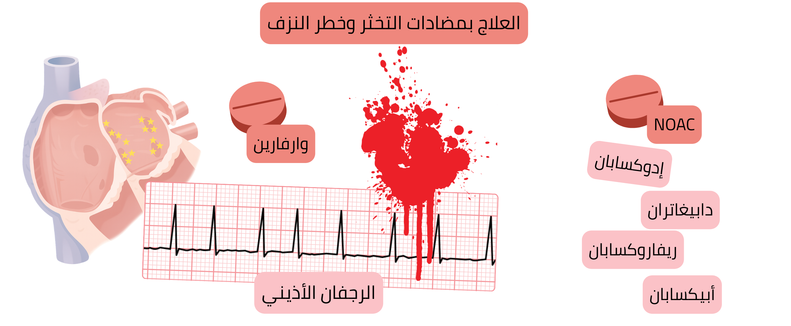 رسم توضيحي يبيّن العلاج المضاد للتخثر في الرجفان الأذيني مع مقارنة الوارفارين ومضادات التخثر الفموية الحديثة وتصوير بصري لمخاطر النزف.