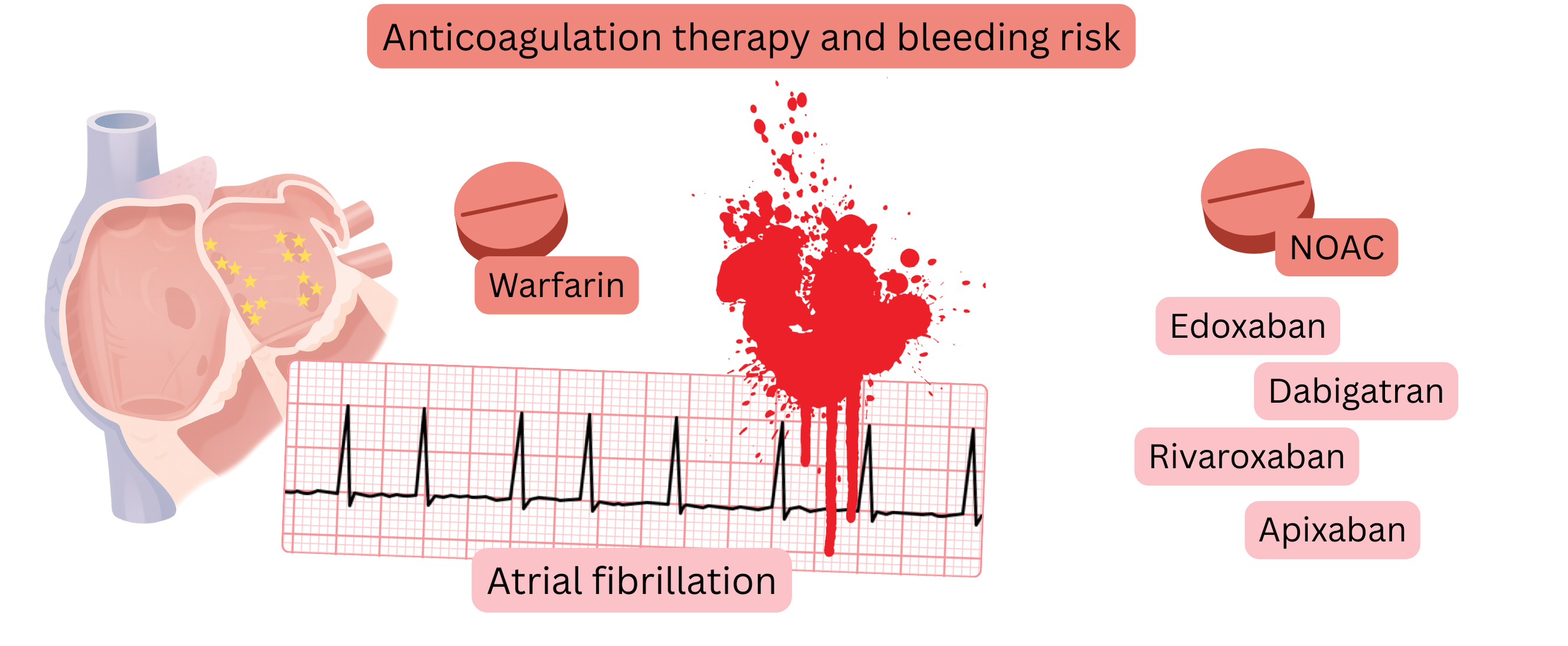 Illustration depicting anticoagulant therapy in atrial fibrillation, comparing warfarin and NOACs with a visual representation of bleeding risk.
