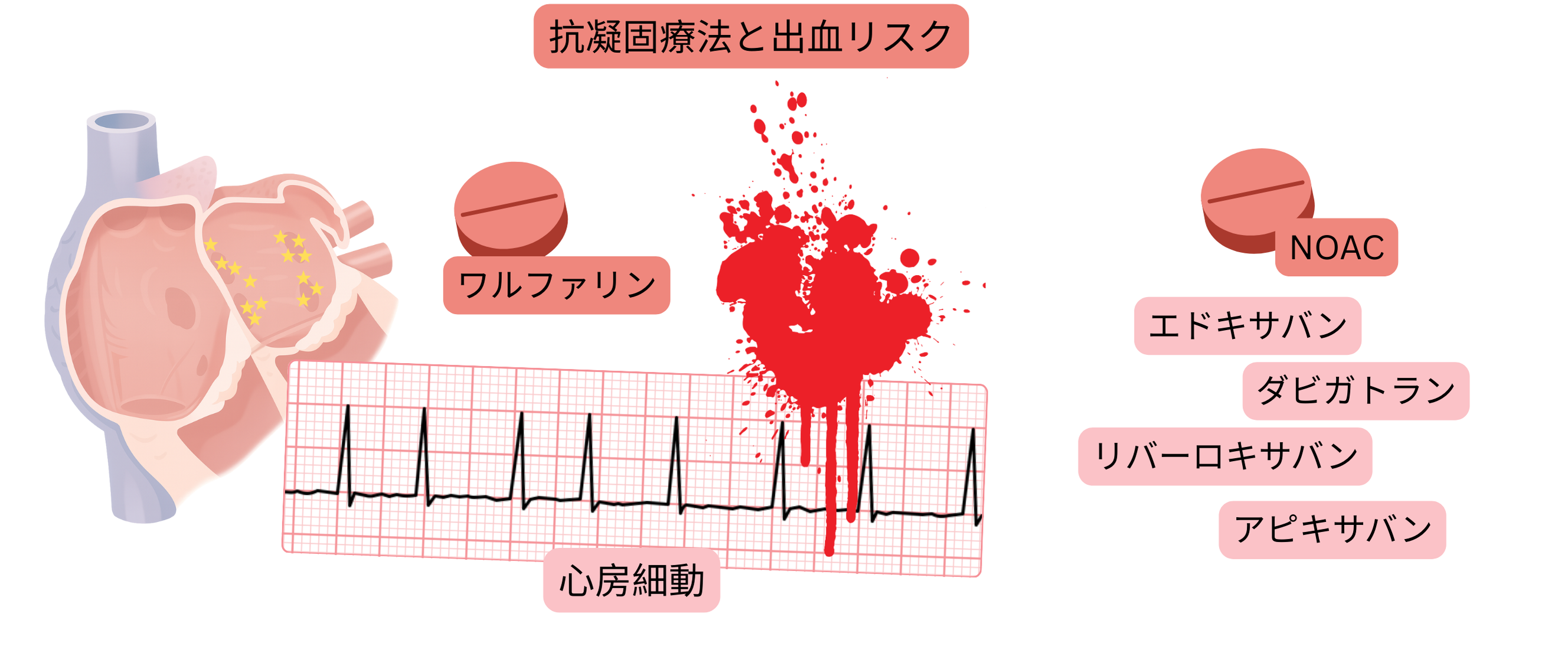 心房細動における抗凝固療法として、ワルファリンとNOACを比較し、出血リスクを視覚的に示した図。