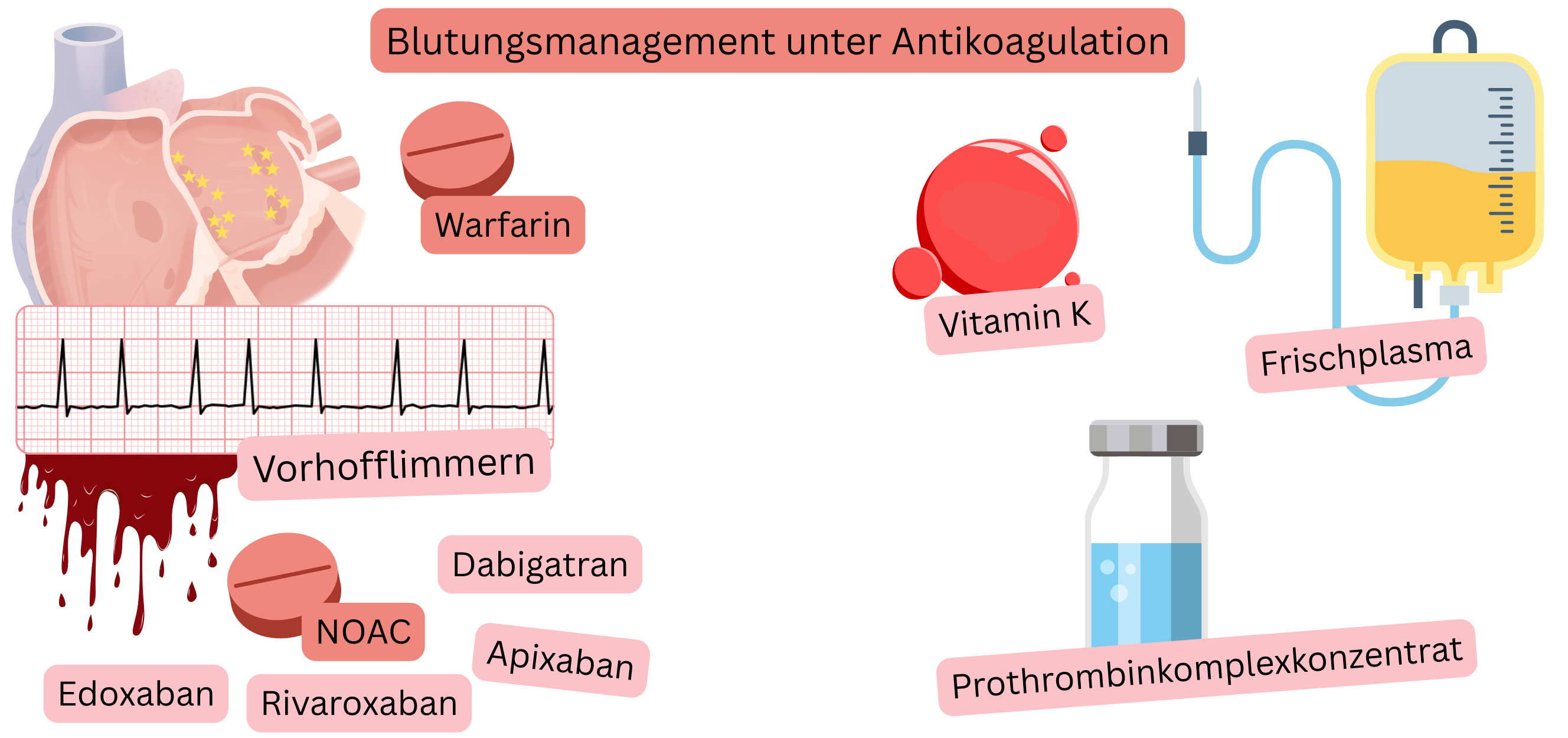Abbildung zur Darstellung der Antikoagulation bei Vorhofflimmern mit Vergleich von Warfarin und NOAK sowie visueller Darstellung des Blutungsrisikos.