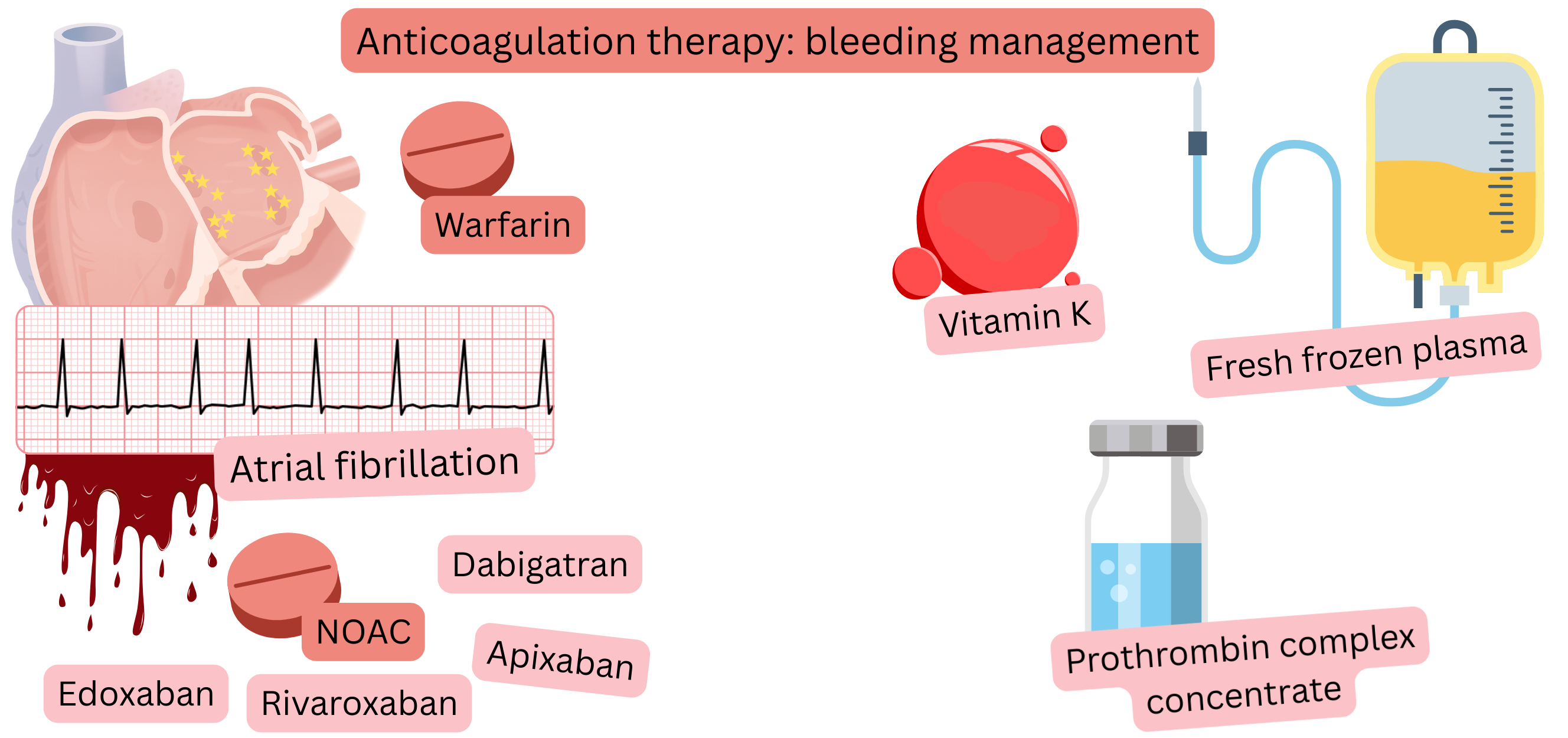 Illustration depicting anticoagulant therapy in atrial fibrillation, comparing warfarin and NOACs with a visual representation of bleeding risk.