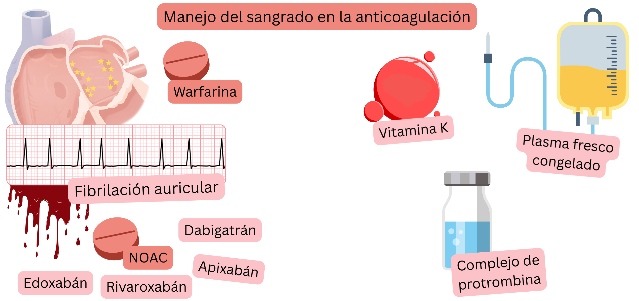 Ilustración que muestra el tratamiento anticoagulante en la fibrilación auricular, comparando warfarina y NOAC, con una representación visual del riesgo hemorrágico.