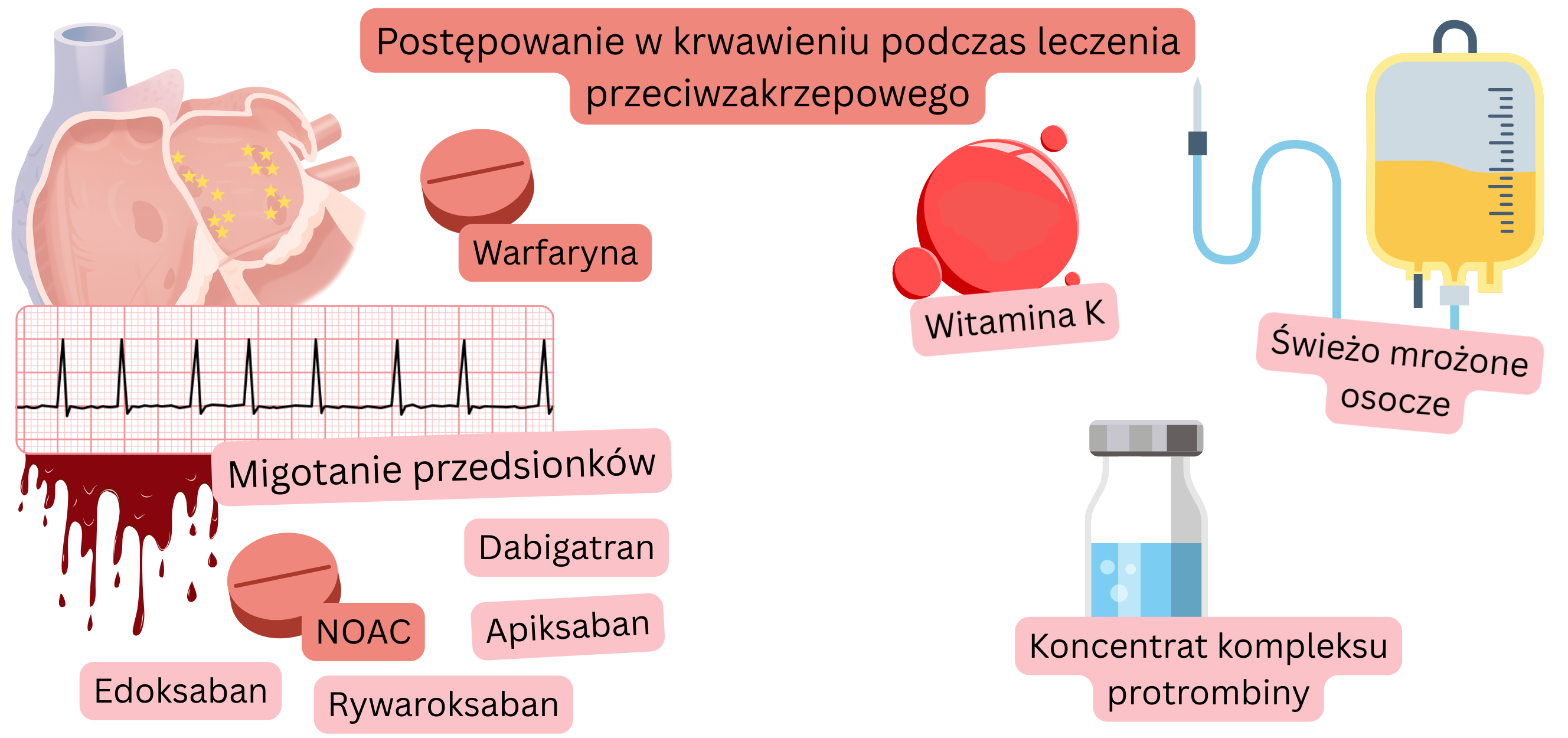 Ilustracja przedstawiająca leczenie przeciwkrzepliwe w migotaniu przedsionków z porównaniem warfaryny i NOAC oraz wizualizacją ryzyka krwawienia.