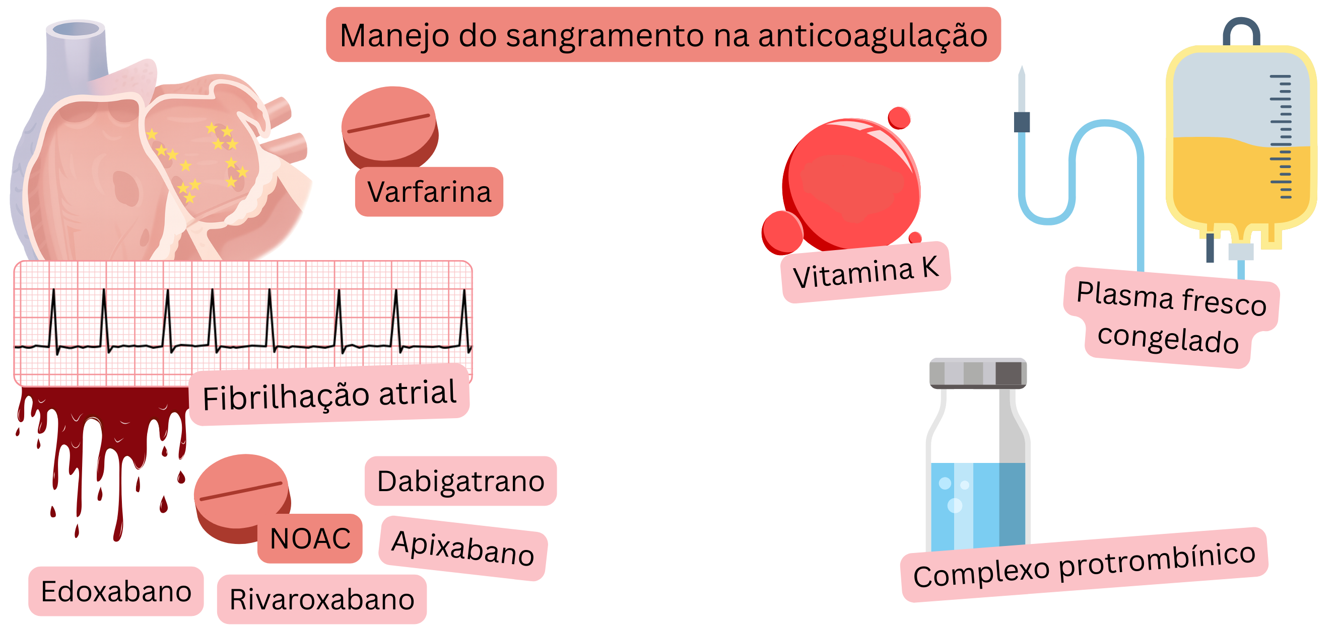 Ilustração que demonstra a terapêutica anticoagulante na fibrilação atrial, comparando a varfarina e os NOAC, com representação visual do risco hemorrágico.