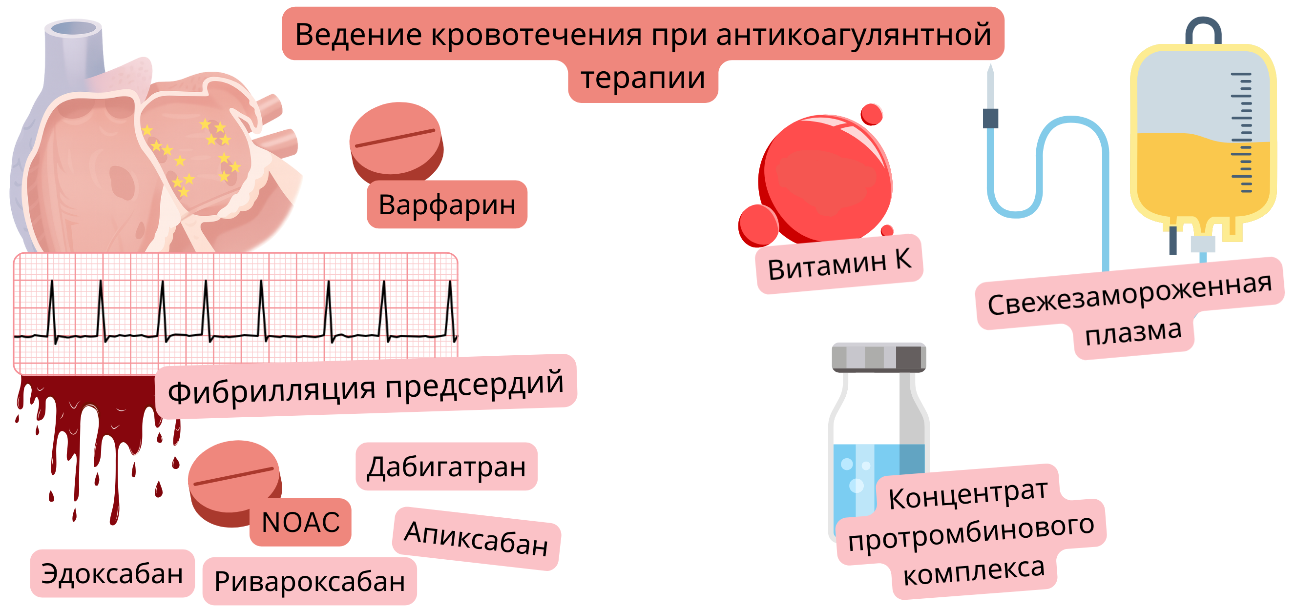 Иллюстрация, демонстрирующая антикоагулянтную терапию при фибрилляции предсердий с сравнением варфарина и НОАК и визуализацией риска кровотечений.