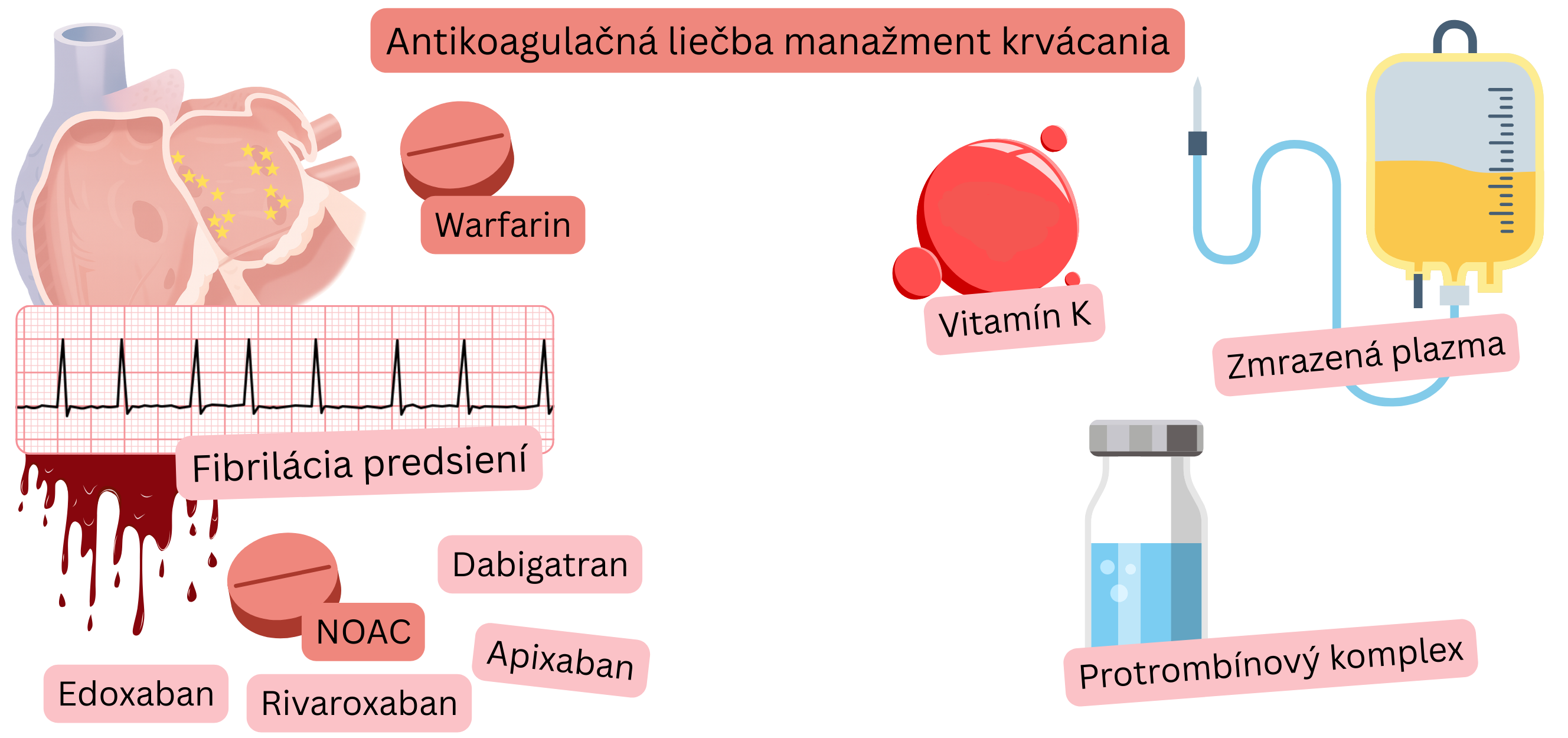 Ilustrácia znázorňujúca antikoagulačnú liečbu pri fibrilácii predsiení s porovnaním warfarínu a NOAC a s vizuálnym znázornením rizika krvácania.