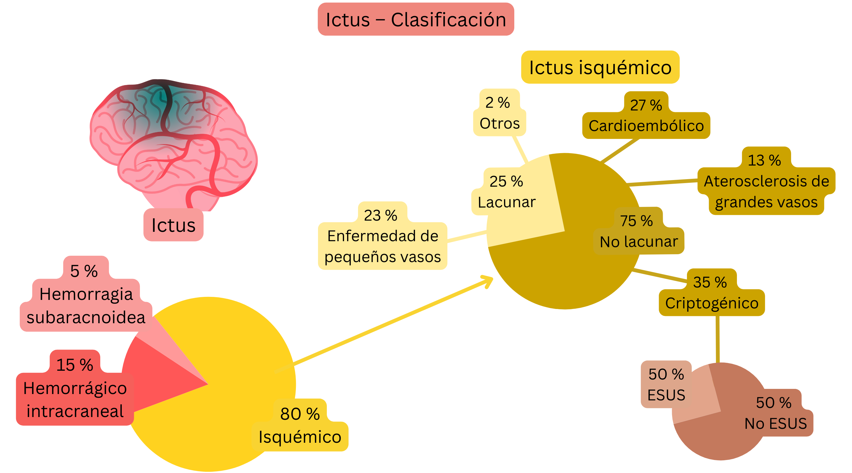 Infografía que muestra la división del ictus en formas isquémica y hemorrágica, con una clasificación detallada del ictus isquémico según el mecanismo, incluyendo lacunar, cardioembólico, aterosclerosis de grandes vasos, criptogénico y ESUS.