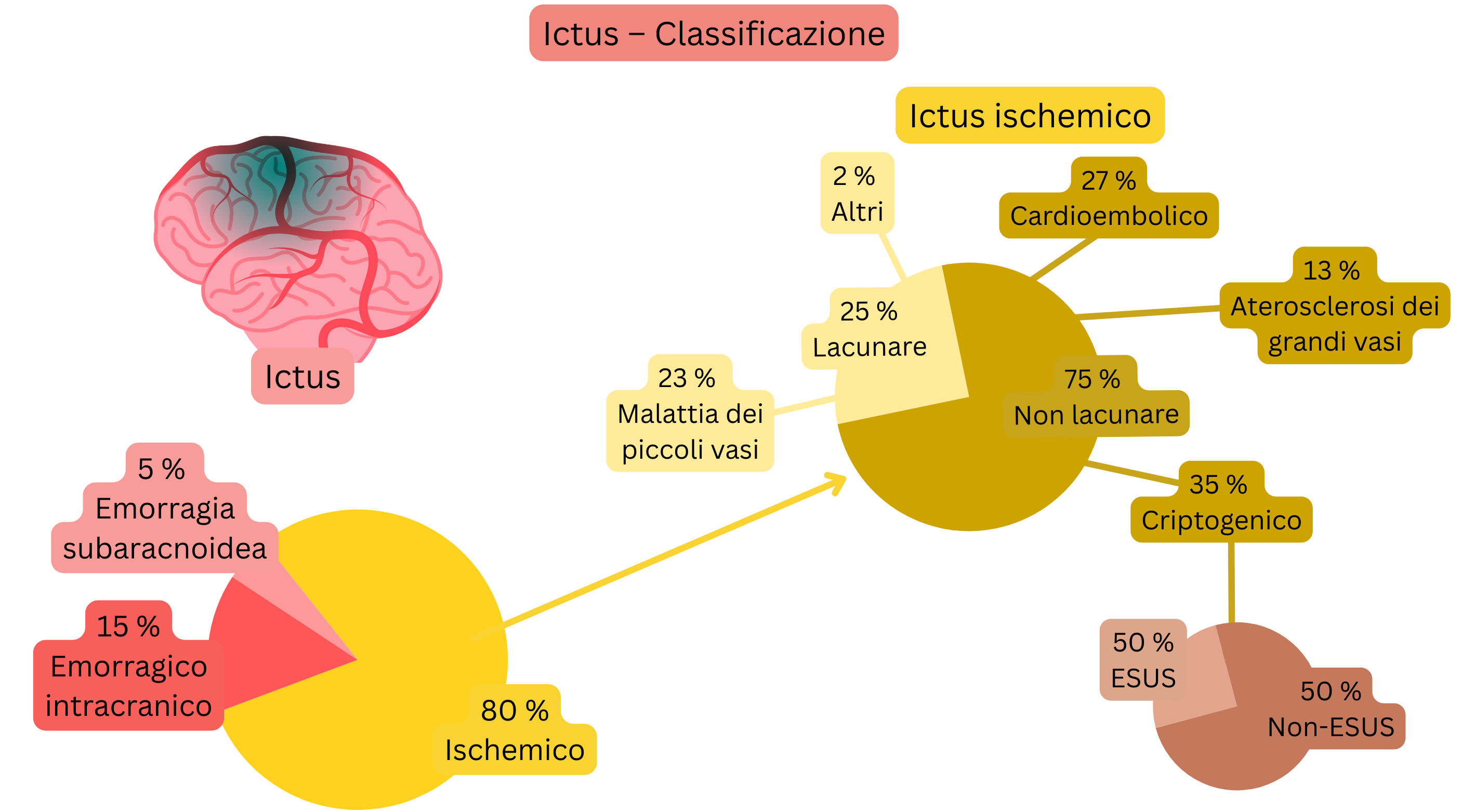 Infografica che mostra la suddivisione dell’ictus in forme ischemica ed emorragica, con una classificazione dettagliata dell’ictus ischemico per meccanismo, includendo lacunare, cardioembolico, aterosclerosi dei grandi vasi, criptogenico ed ESUS.