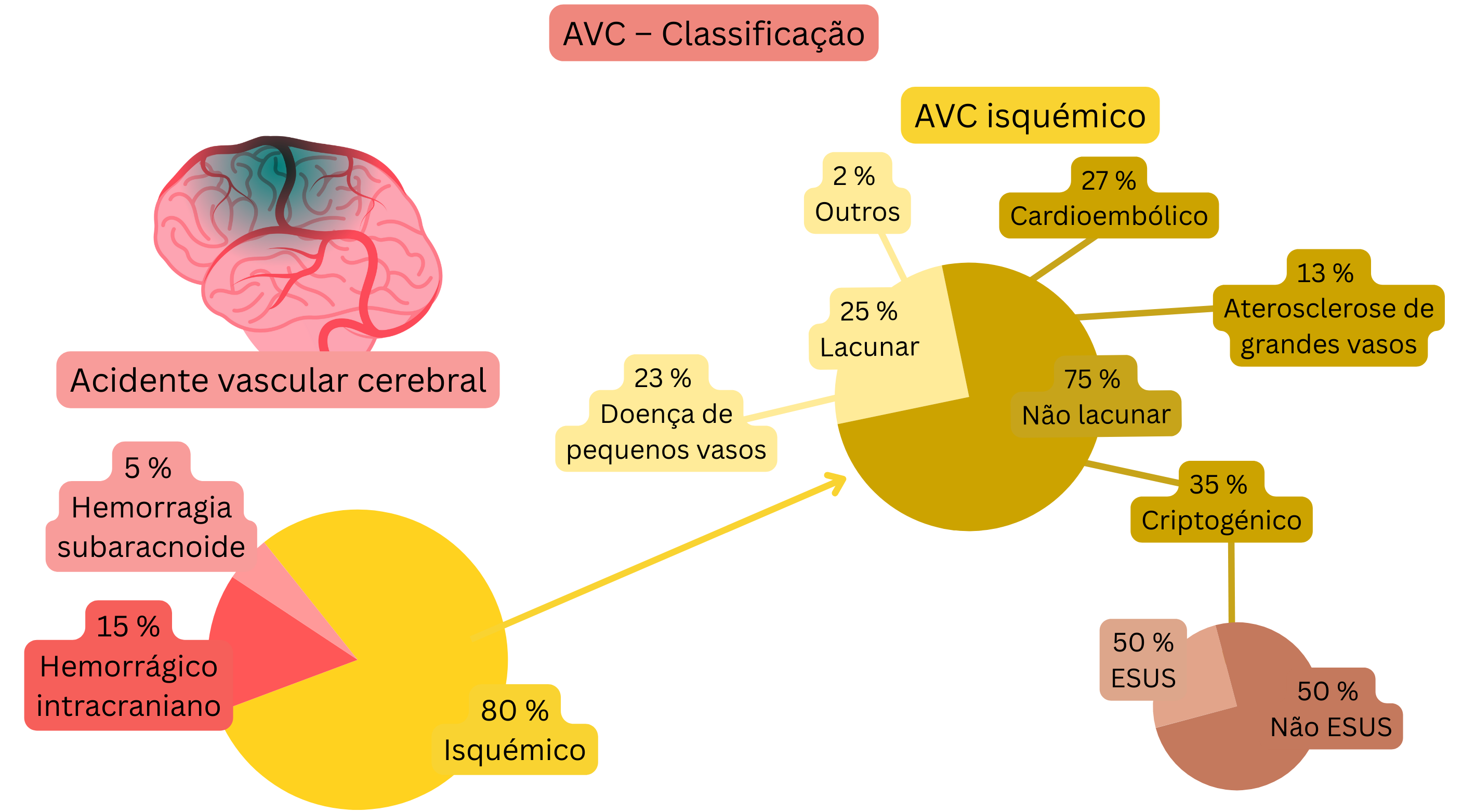 Infográfico que demonstra a divisão do acidente vascular cerebral em formas isquémica e hemorrágica, com classificação detalhada do AVC isquémico por mecanismo, incluindo lacunar, cardioembólico, aterosclerose de grandes vasos, criptogénico e ESUS.