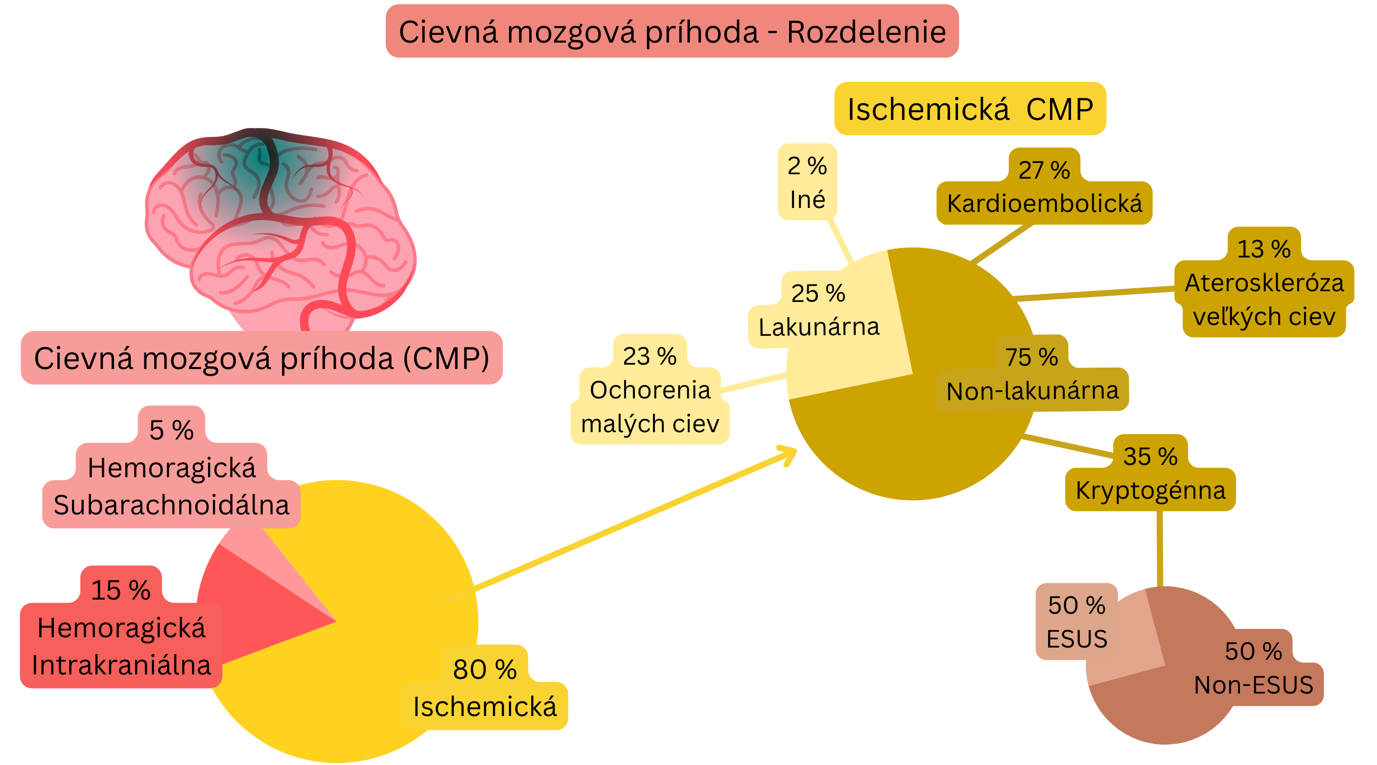 Infografika znázorňujúca rozdelenie cievnej mozgovej príhody na ischemickú a hemoragickú formu s podrobnou klasifikáciou ischemickej CMP podľa mechanizmu vzniku vrátane lakunárnej, kardioembolickej, aterosklerózy veľkých ciev, kryptogénnej a ESUS.