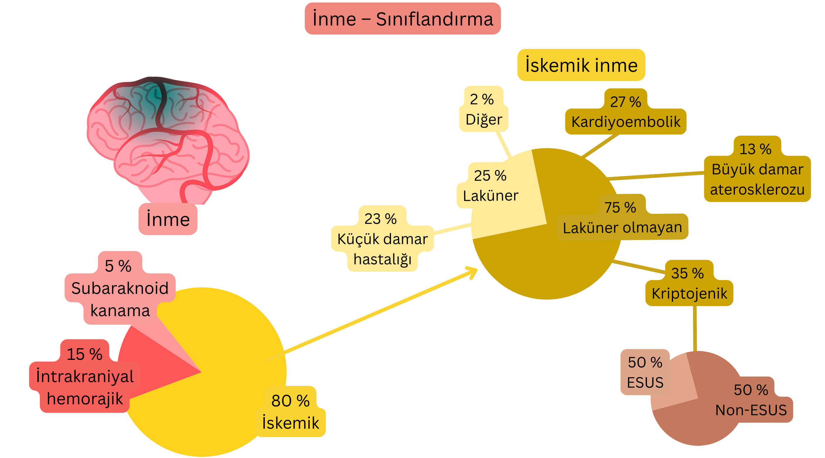İnmenin iskemik ve hemorajik formlara ayrımını gösteren, iskemik inmenin oluş mekanizmasına göre laküner, kardiyoembolik, büyük damar aterosklerozu, kriptojenik inme ve ESUS alt tiplerini ayrıntılı olarak sınıflandıran infografik.