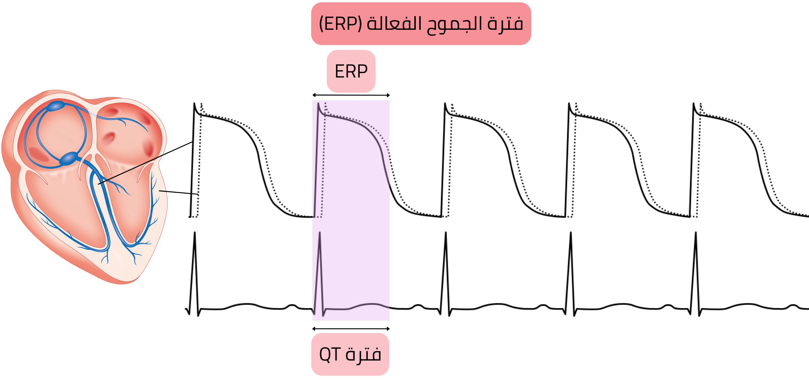 مخطط الفترة المقاومة الفعالة لعضلة القلب يوضح العلاقة بين جهد الفعل، الفترة المقاومة الفعالة، وفترة QT على تخطيط القلب.