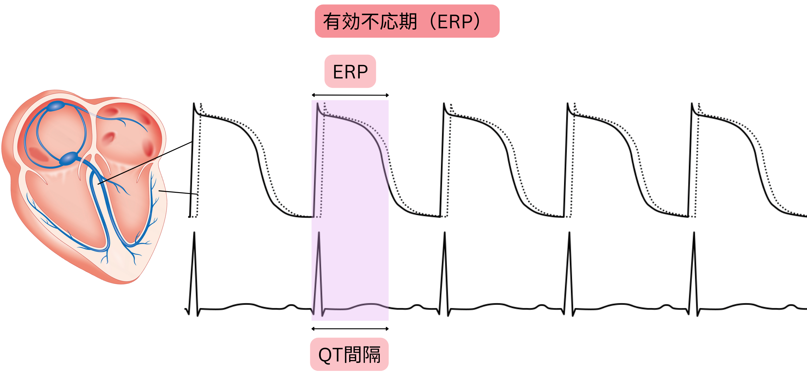 心筋の有効不応期を示す模式図で、活動電位、有効不応期、および心電図QT間隔の関係を示す。