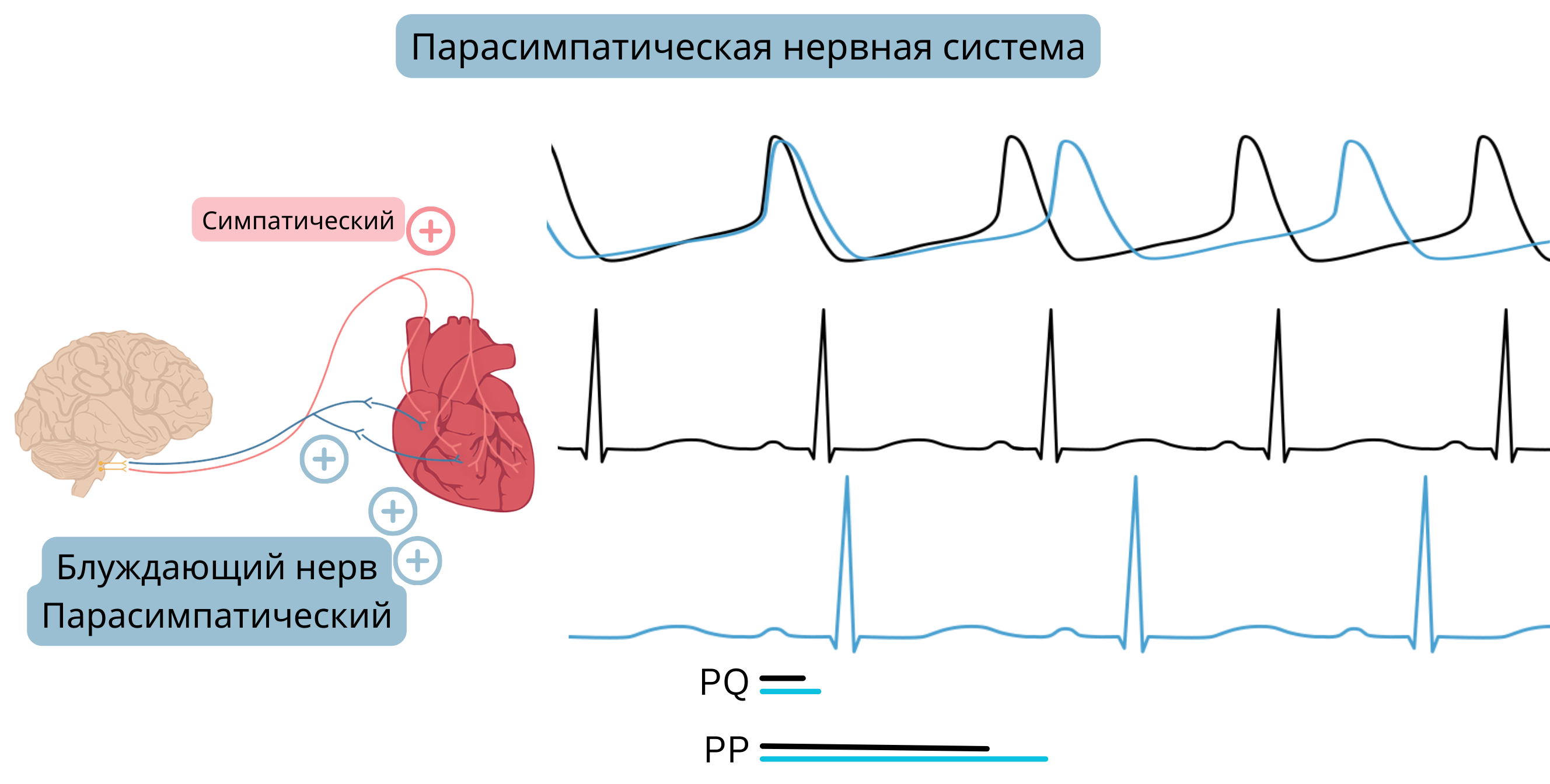 Схема преобладания парасимпатической нервной системы, демонстрирующая повышение активности блуждающего нерва со снижением частоты сердечных сокращений и удлинением интервалов PP и PQ на ЭКГ.