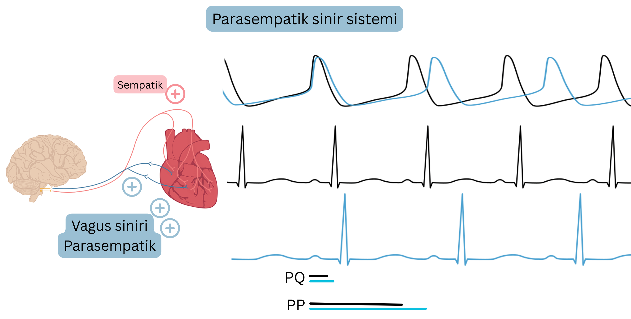 Parasempatik baskınlığı gösteren şema; vagus siniri aktivitesinin artmasıyla kalp hızının azalmasını ve EKG’de PP ile PQ aralıklarının uzamasını göstermektedir.