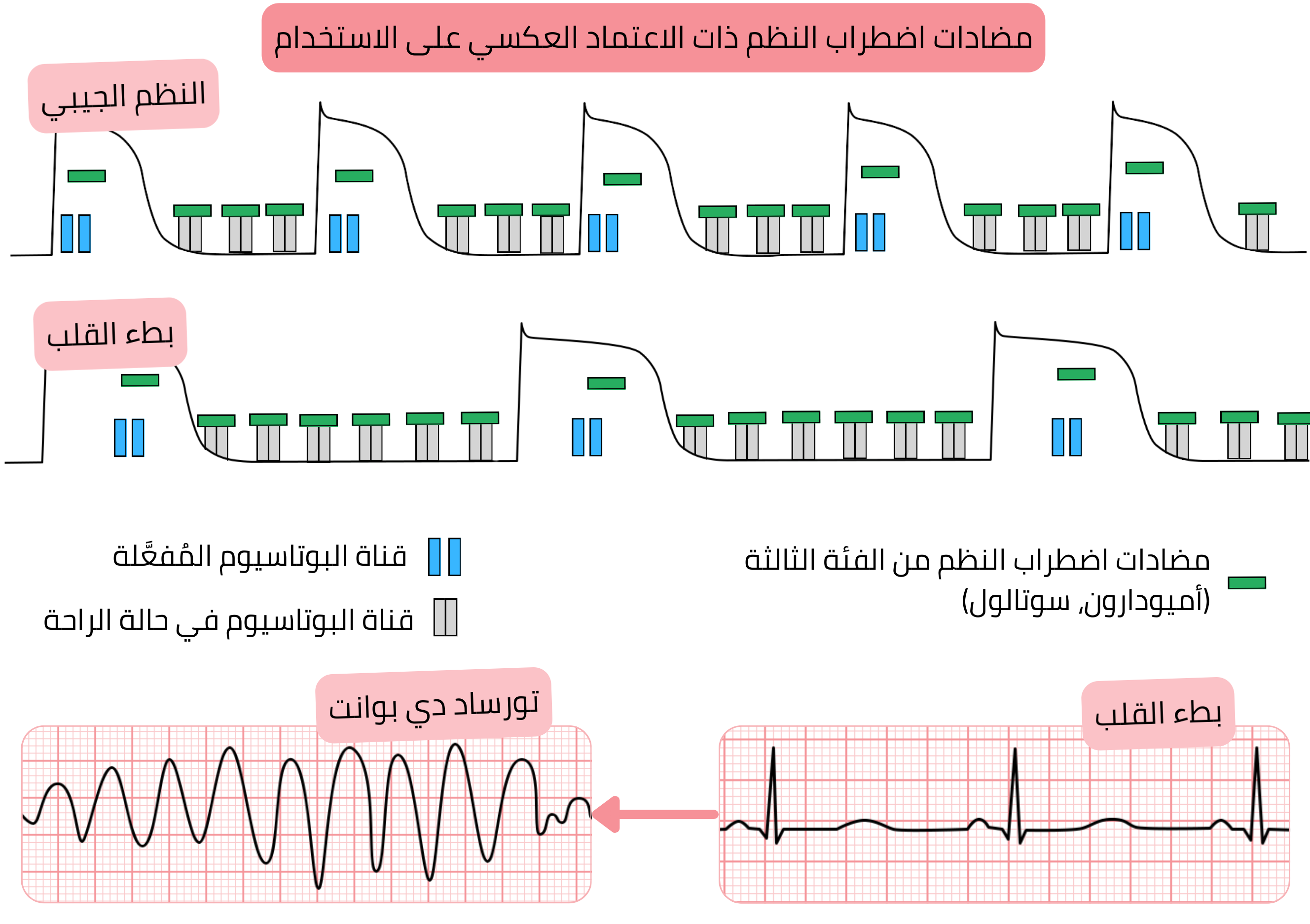 مخطط الاعتماد العكسي على الاستخدام لمضادات اضطراب النظم من الفئة III يوضح زيادة حصر قنوات البوتاسيوم في بطء القلب مع إطالة جهد الفعل وفترة QT وارتفاع خطر torsades de pointes.