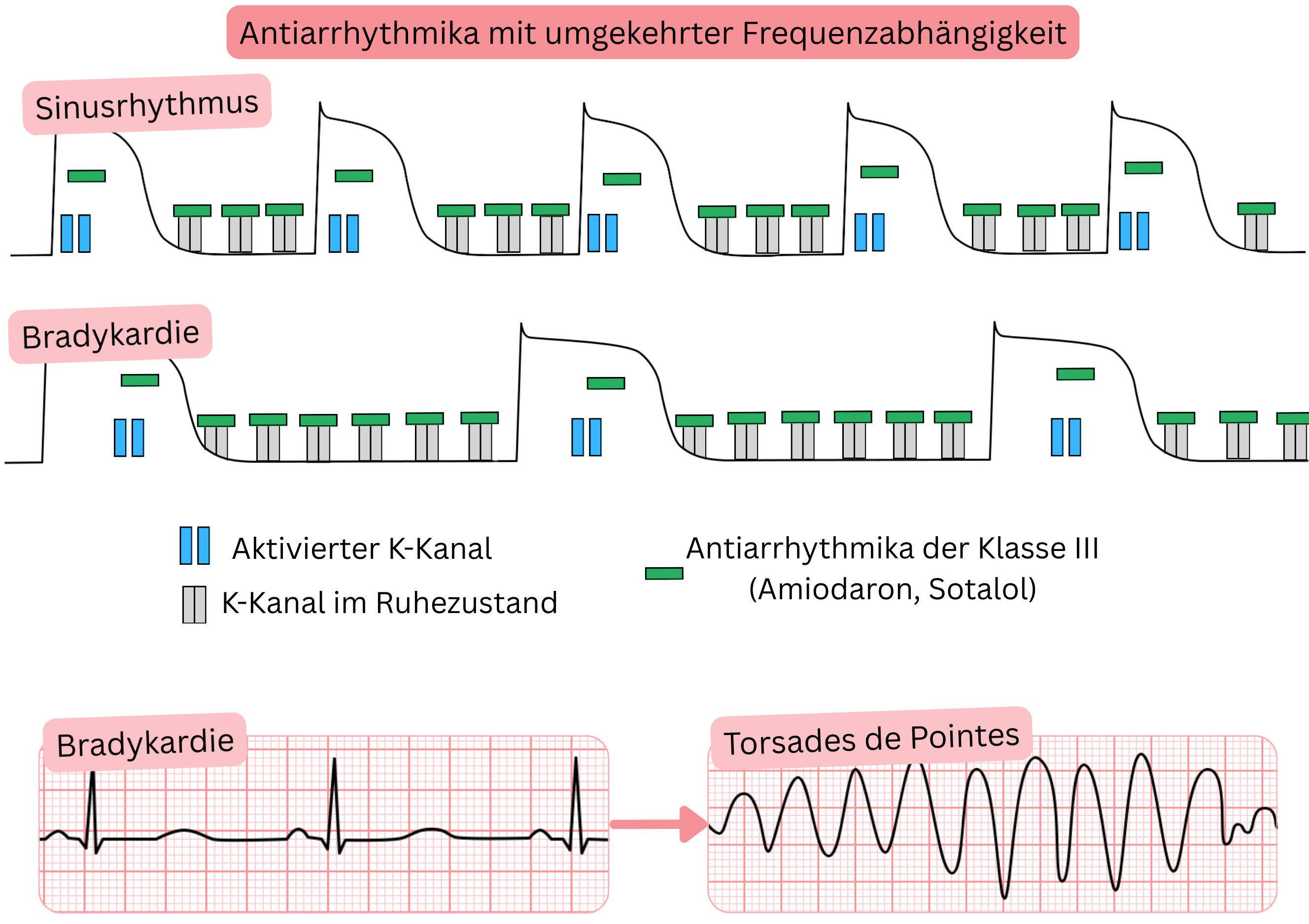 Schema der reversen Use-Dependence von Antiarrhythmika der Klasse III mit Darstellung einer stärkeren Blockade von Kaliumkanälen bei Bradykardie, Verlängerung des Aktionspotenzials, des QT-Intervalls und erhöhtem Risiko für Torsades de pointes.