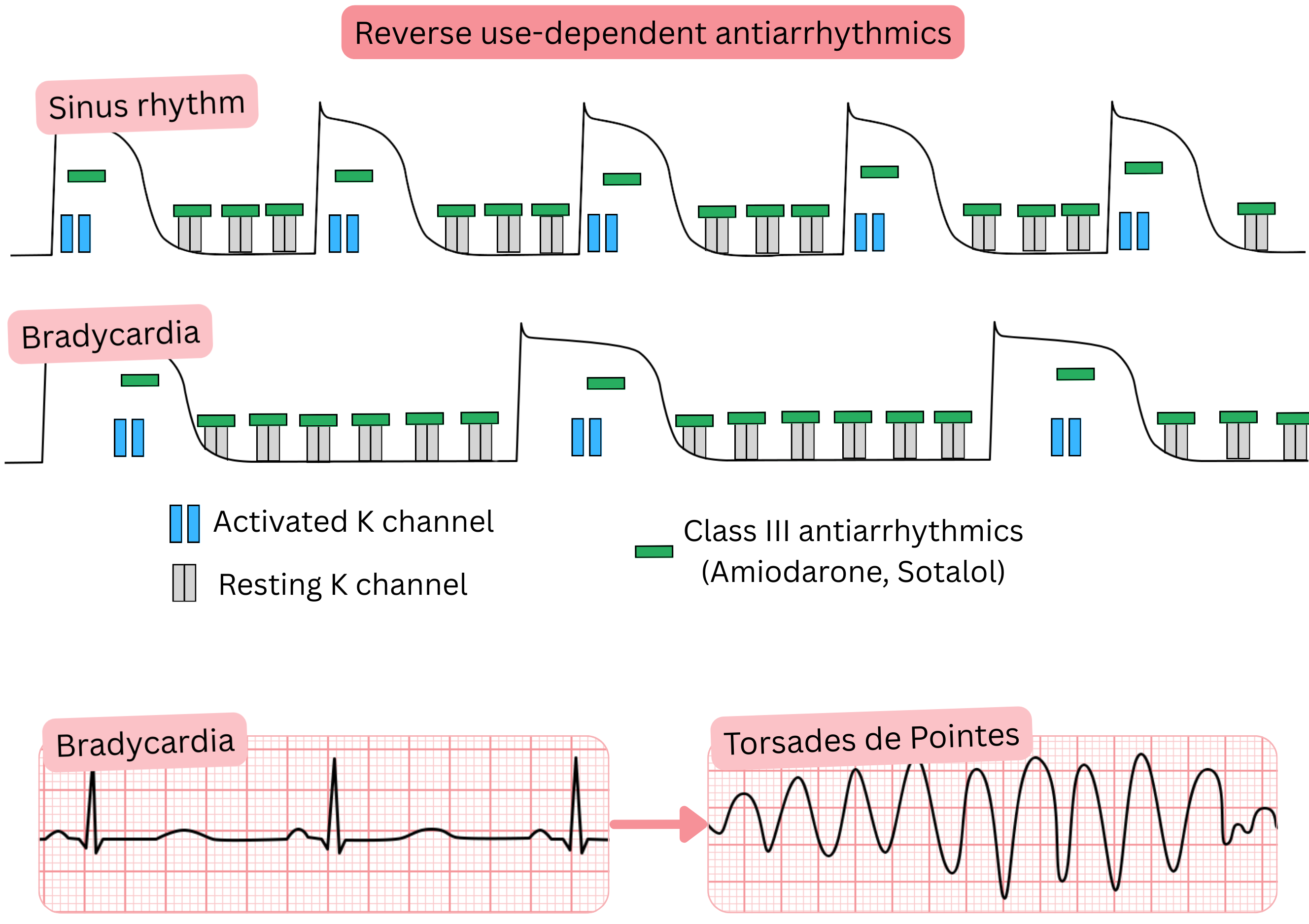 Diagram of reverse use dependence of class III antiarrhythmic drugs illustrating enhanced potassium channel blockade during bradycardia with prolongation of the action potential, QT interval, and increased risk of torsades de pointes.