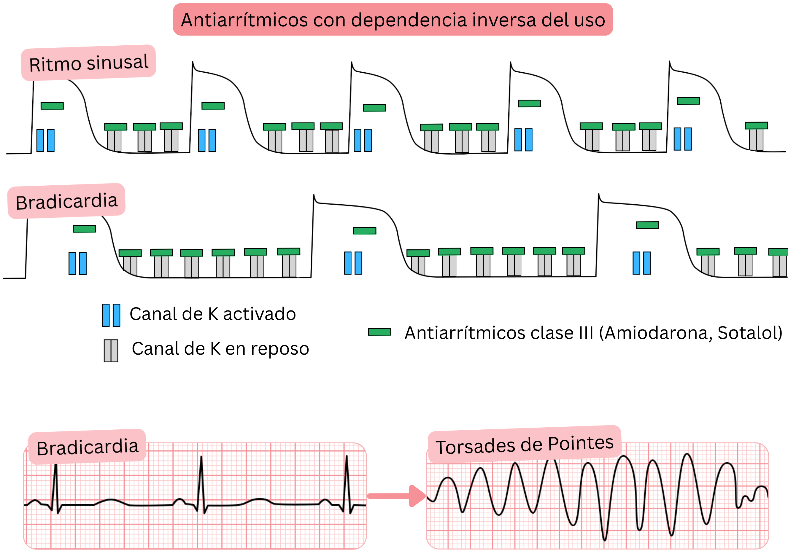 Esquema de la dependencia inversa del uso de los antiarrítmicos de clase III que muestra un bloqueo más pronunciado de los canales de potasio en la bradicardia, con prolongación del potencial de acción, del intervalo QT y aumento del riesgo de torsades de pointes.