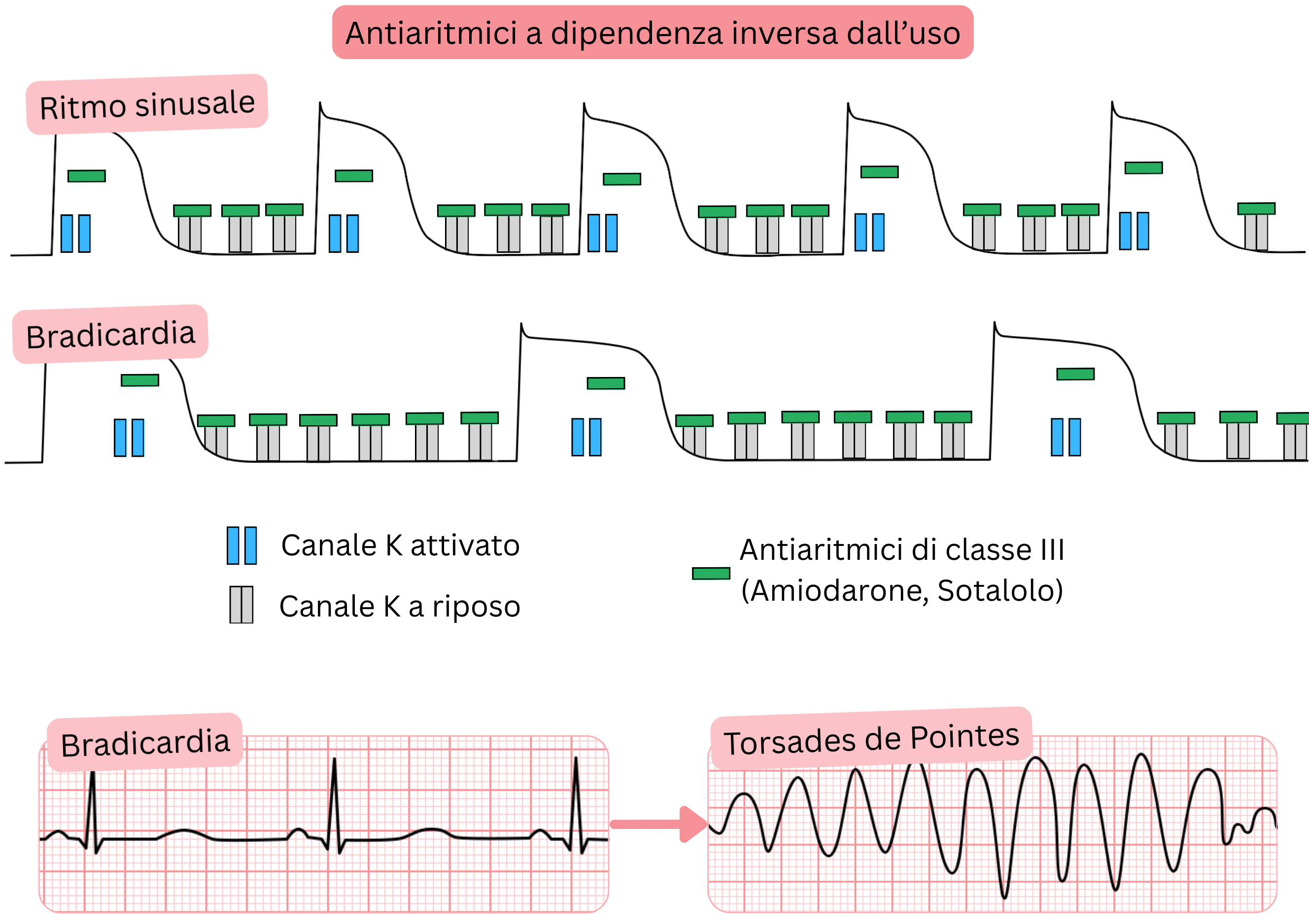 Schema della reverse use-dependence degli antiaritmici di classe III che illustra un blocco più marcato dei canali del potassio in bradicardia, con prolungamento del potenziale d’azione, dell’intervallo QT e aumento del rischio di torsades de pointes.