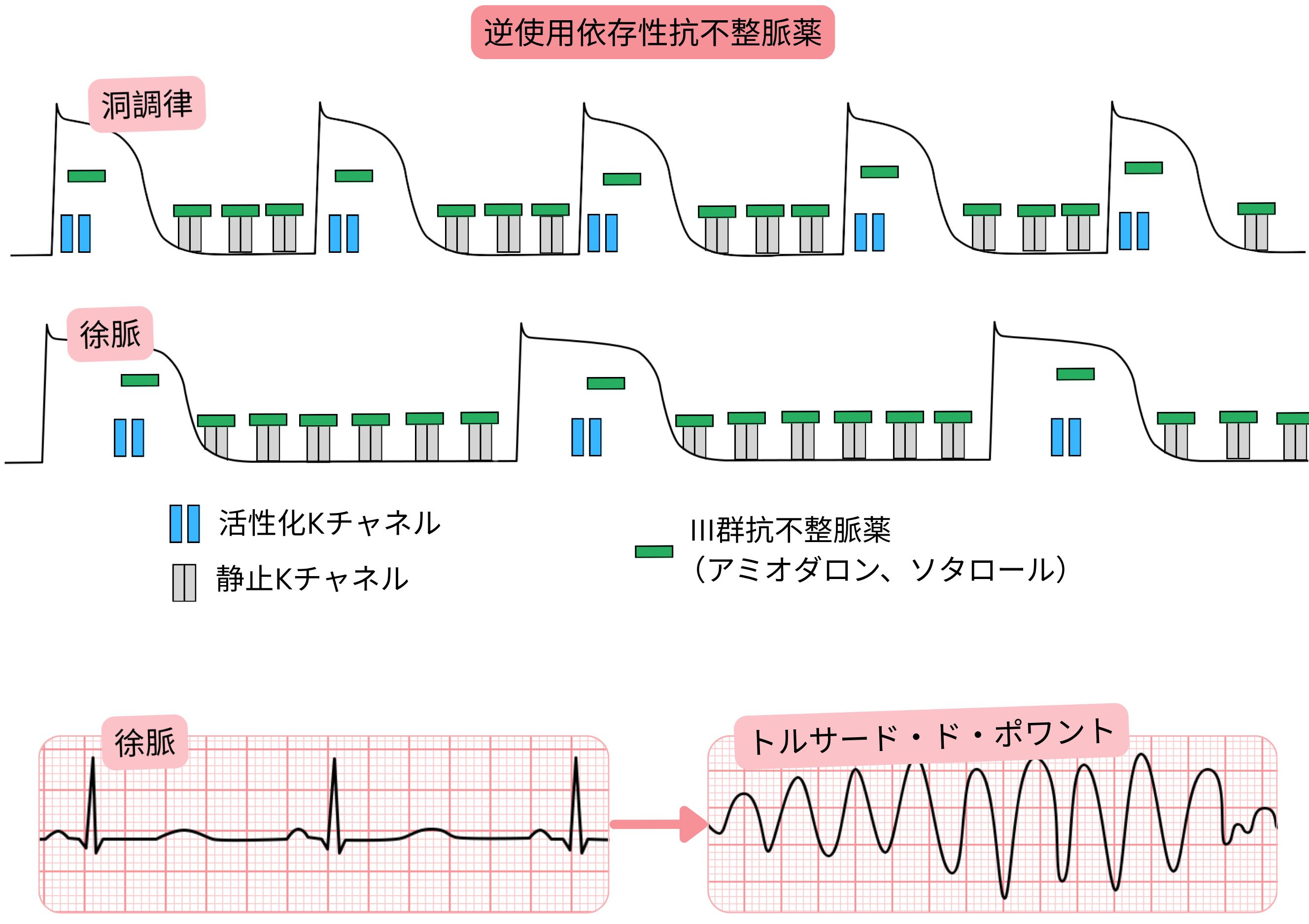 III群抗不整脈薬の逆使用依存性を示す模式図で、徐脈時にカリウムチャネル遮断が増強し、活動電位およびQT間隔の延長とtorsades de pointesのリスク増加を示す。