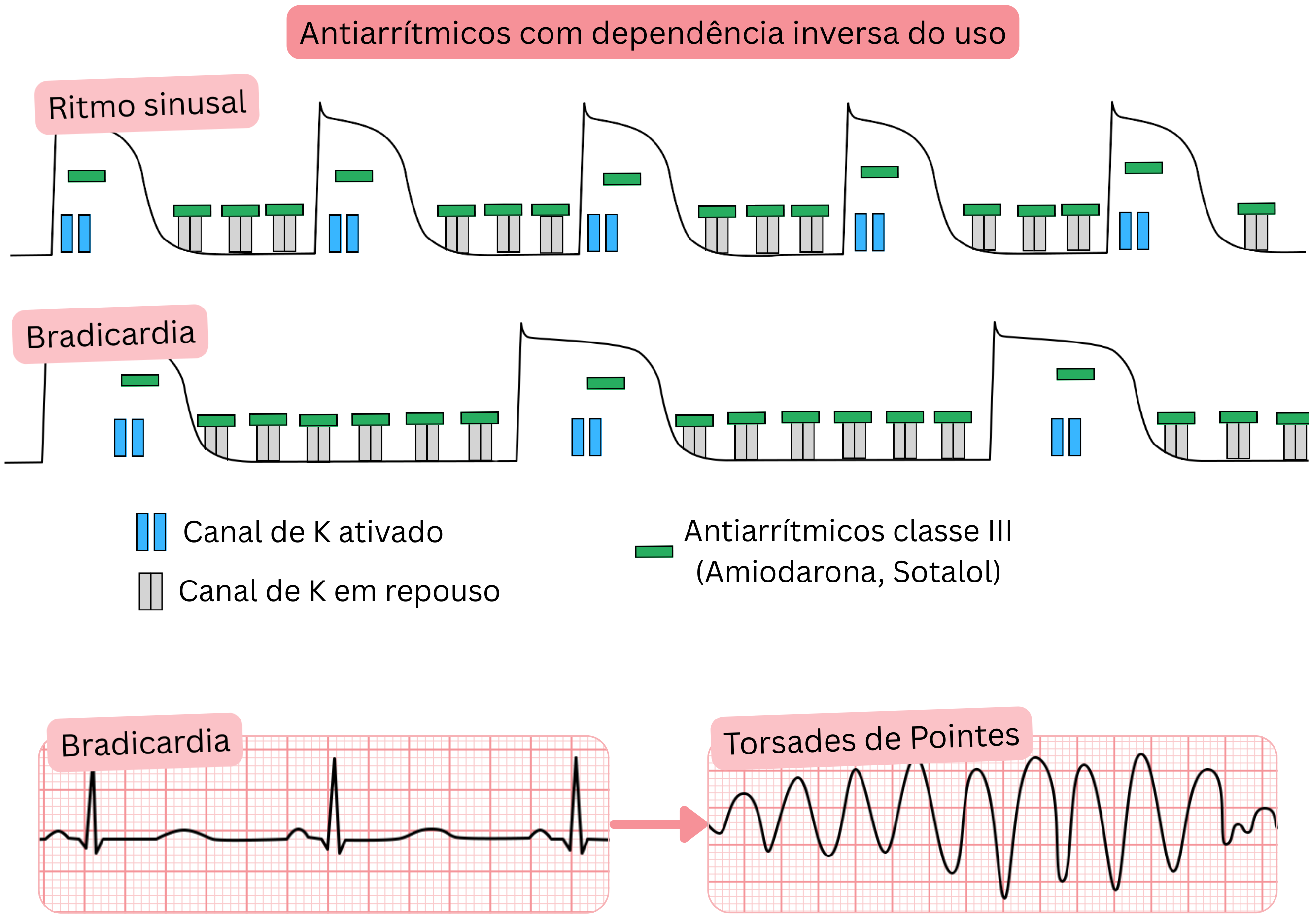 Esquema da dependência inversa do uso dos antiarrítmicos de classe III mostrando bloqueio mais acentuado dos canais de potássio na bradicardia, com prolongamento do potencial de ação, do intervalo QT e aumento do risco de torsades de pointes.