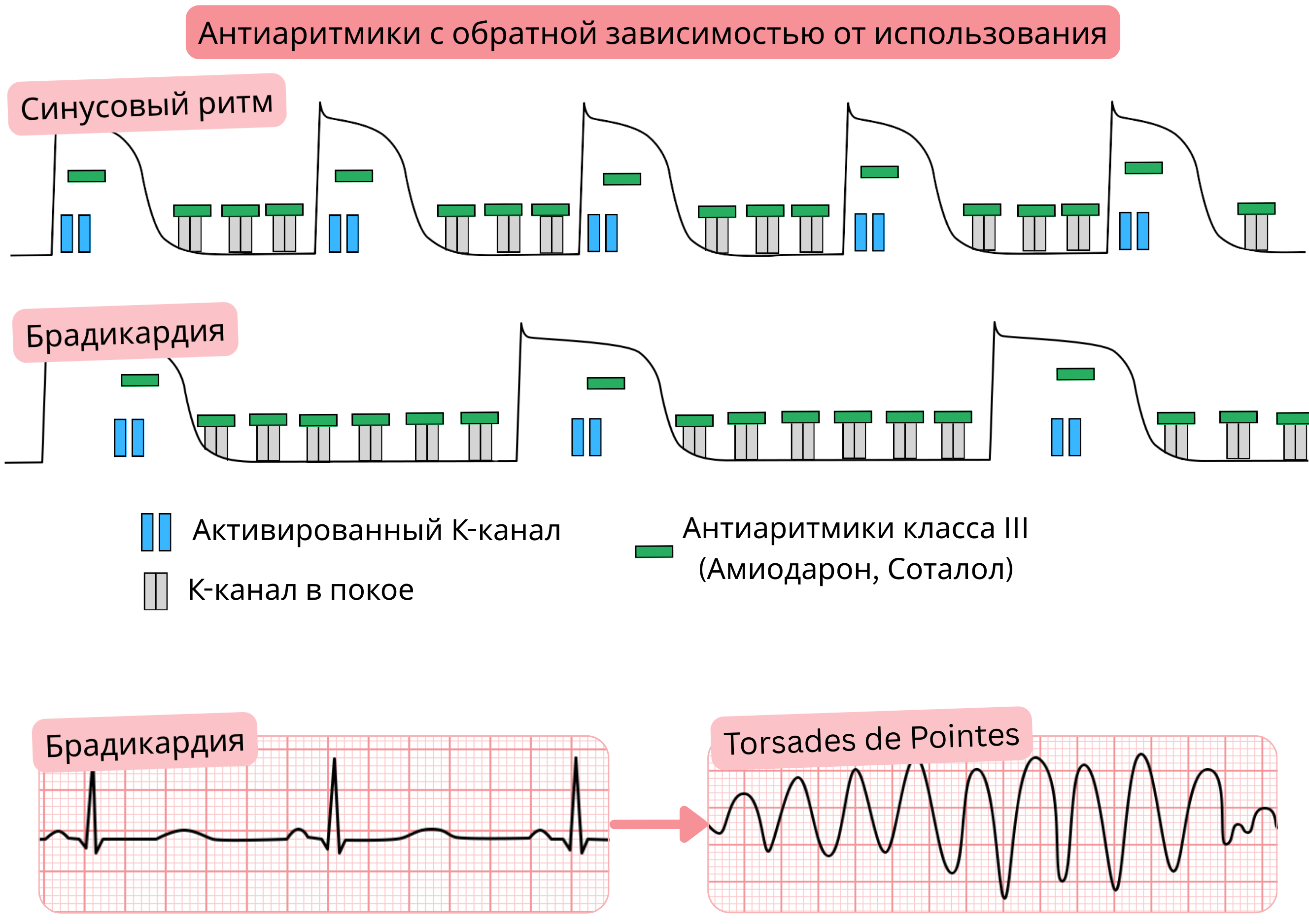 Схема обратной зависимости от использования антиаритмических препаратов класса III, демонстрирующая более выраженную блокаду калиевых каналов при брадикардии с удлинением потенциала действия, интервала QT и повышенным риском torsades de pointes.