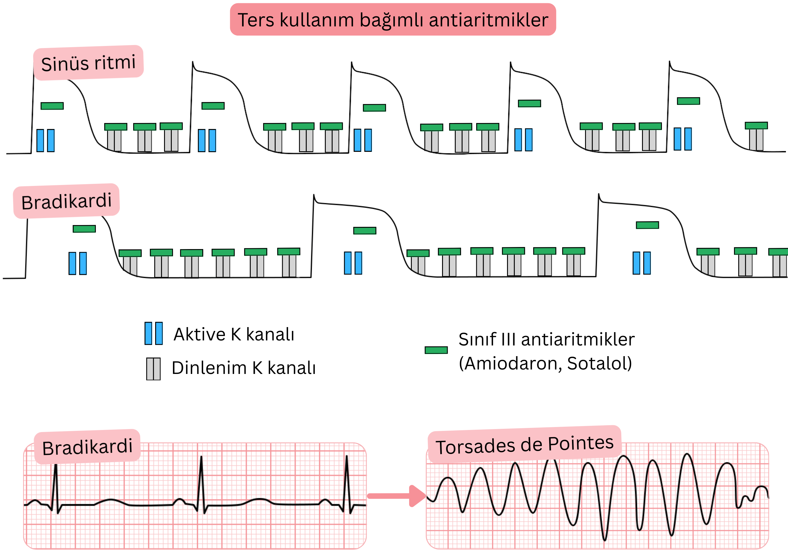Sınıf III antiaritmiklerin ters use-dependence özelliğini gösteren şema; bradikardide potasyum kanal blokajının daha belirgin olduğunu, aksiyon potansiyeli ve QT aralığının uzadığını ve torsades de pointes riskinin arttığını gösterir.
