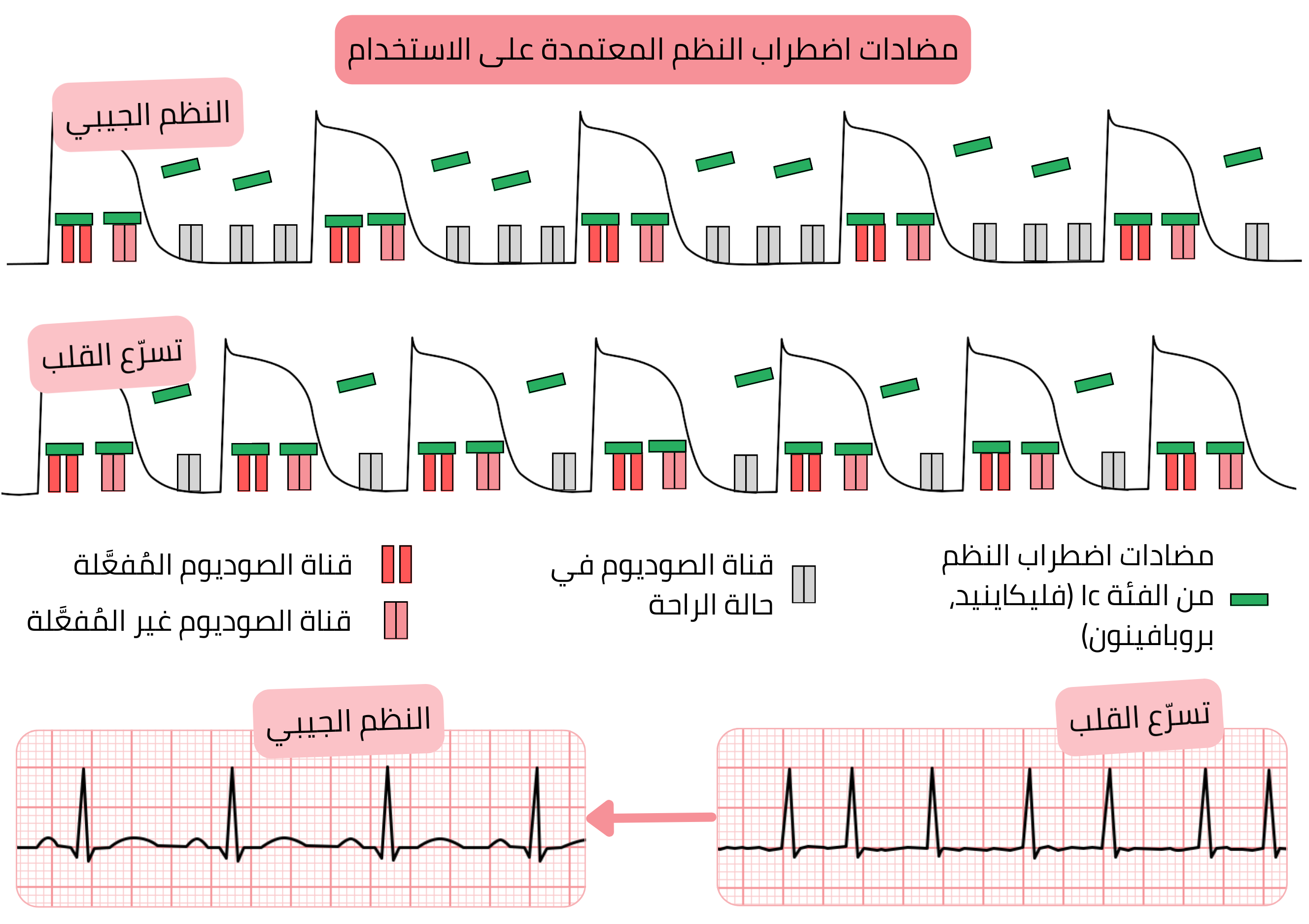 مخطط الاعتماد على الاستخدام لمضادات اضطراب النظم من الفئة IC يوضح الحصار المعتمد على التردد لقنوات الصوديوم أثناء تسرع القلب مقارنةً بالنظم الجيبي مع تأثير فليكائينيد وبروبافينون.