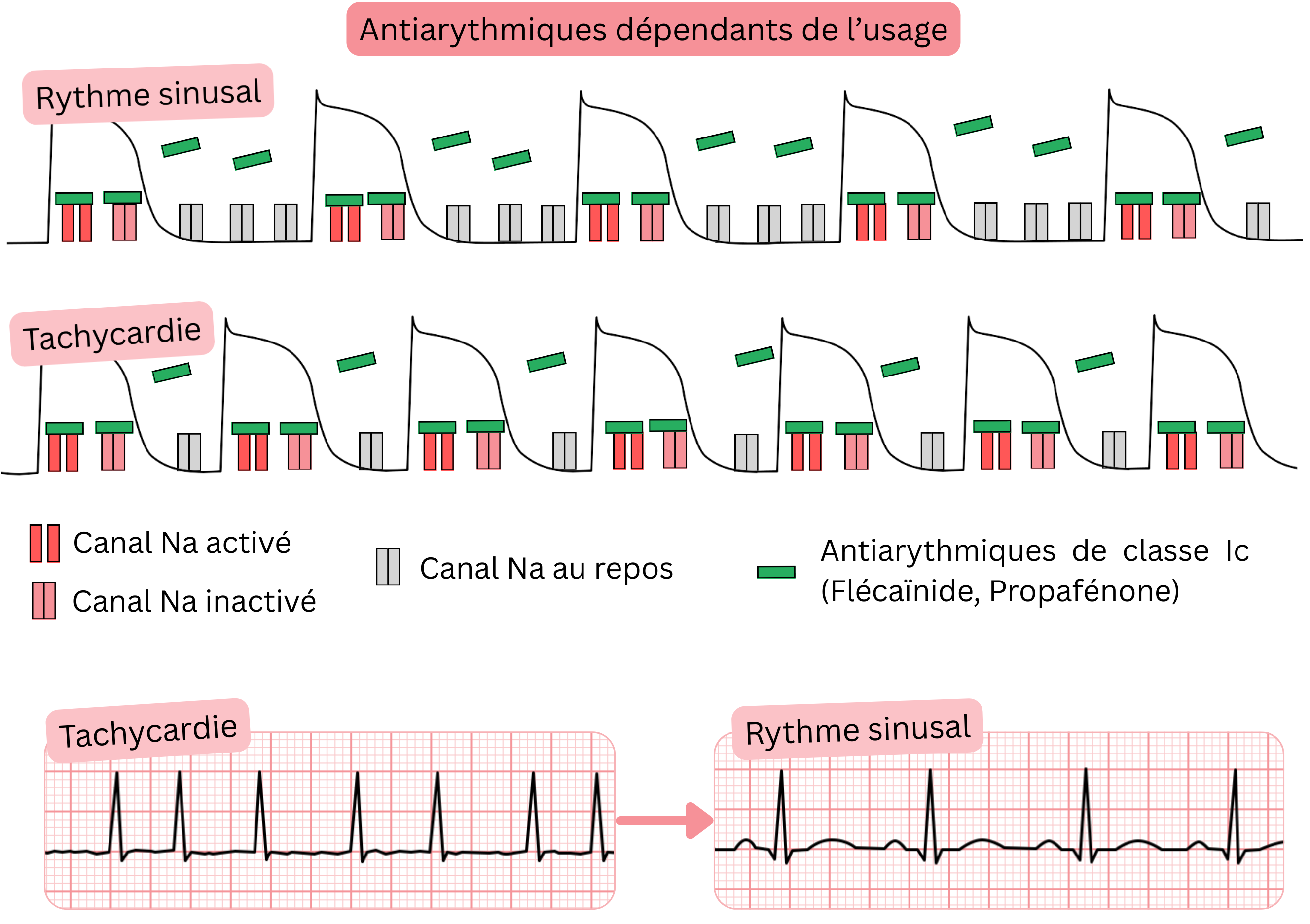Schéma de la dépendance à l’usage des antiarythmiques de classe IC illustrant le blocage des canaux sodiques dépendant de la fréquence en tachycardie par rapport au rythme sinusal, avec l’effet de la flécaïnide et de la propafénone.