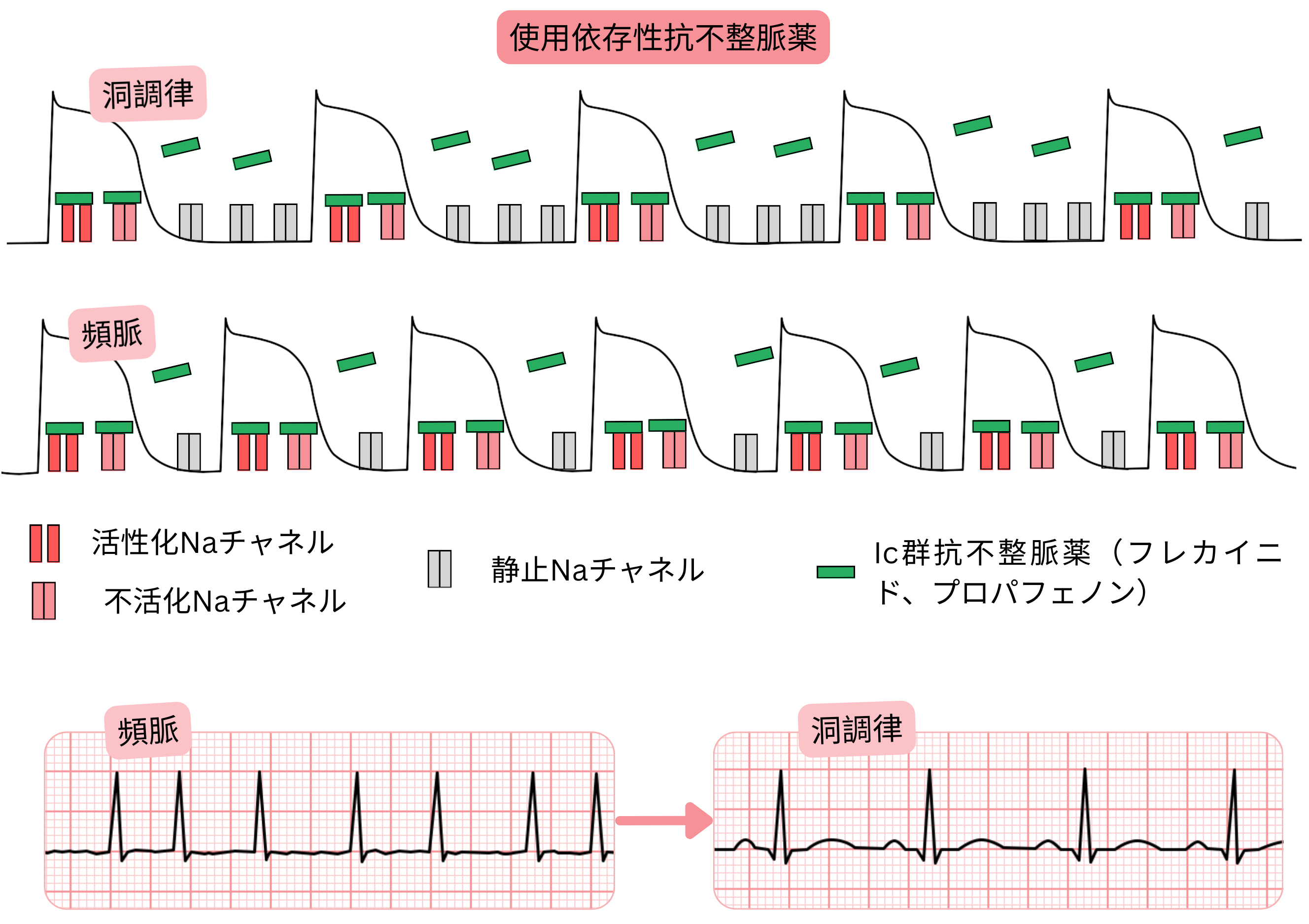 IC群抗不整脈薬の使用依存性を示す模式図で、洞調律と比較した頻脈時の周波数依存性ナトリウムチャネル遮断とフレカイニドおよびプロパフェノンの作用を示す。