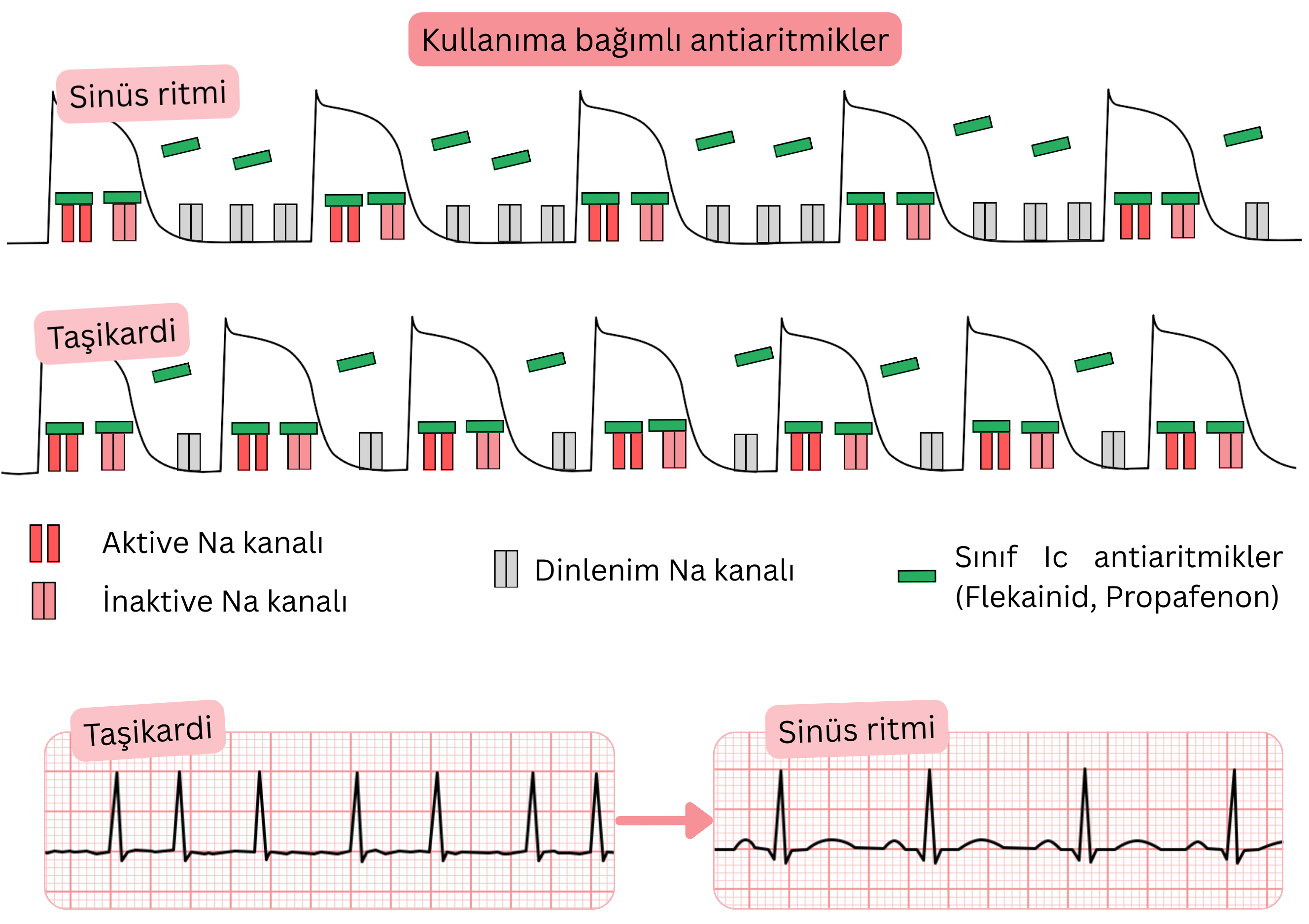 Sınıf IC antiaritmiklerin use-dependence özelliğini gösteren şema; sinüs ritmine kıyasla taşikardide frekansa bağlı sodyum kanal blokajını ve flekainid ile propafenonun etkisini ortaya koyar.