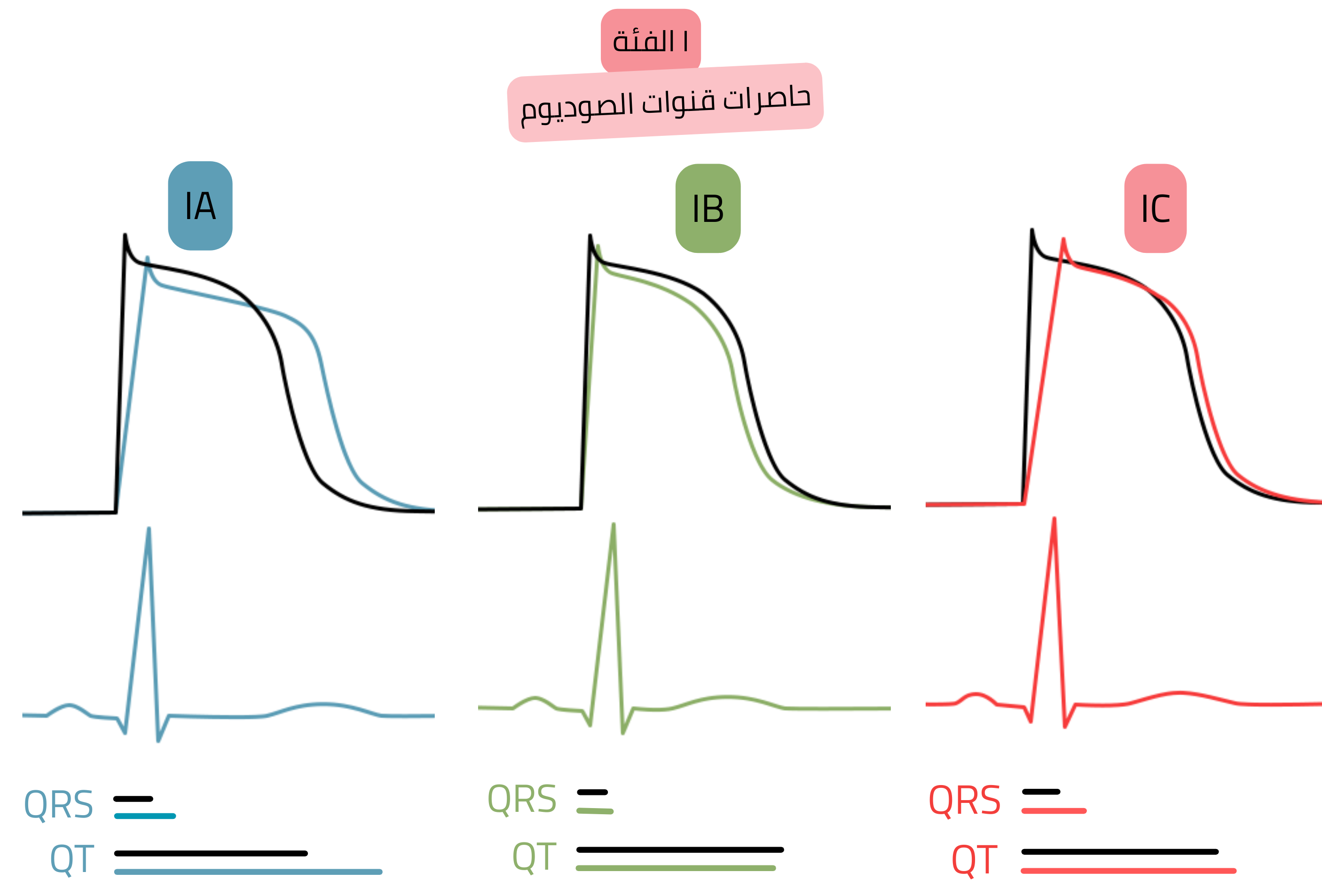 مخطط تأثير مضادات اضطراب النظم من الفئة I يوضح الفروق بين الأنواع الفرعية IA وIB وIC من حيث التأثير على جهد الفعل، عرض مركب QRS، وطول فترة QT على تخطيط القلب.