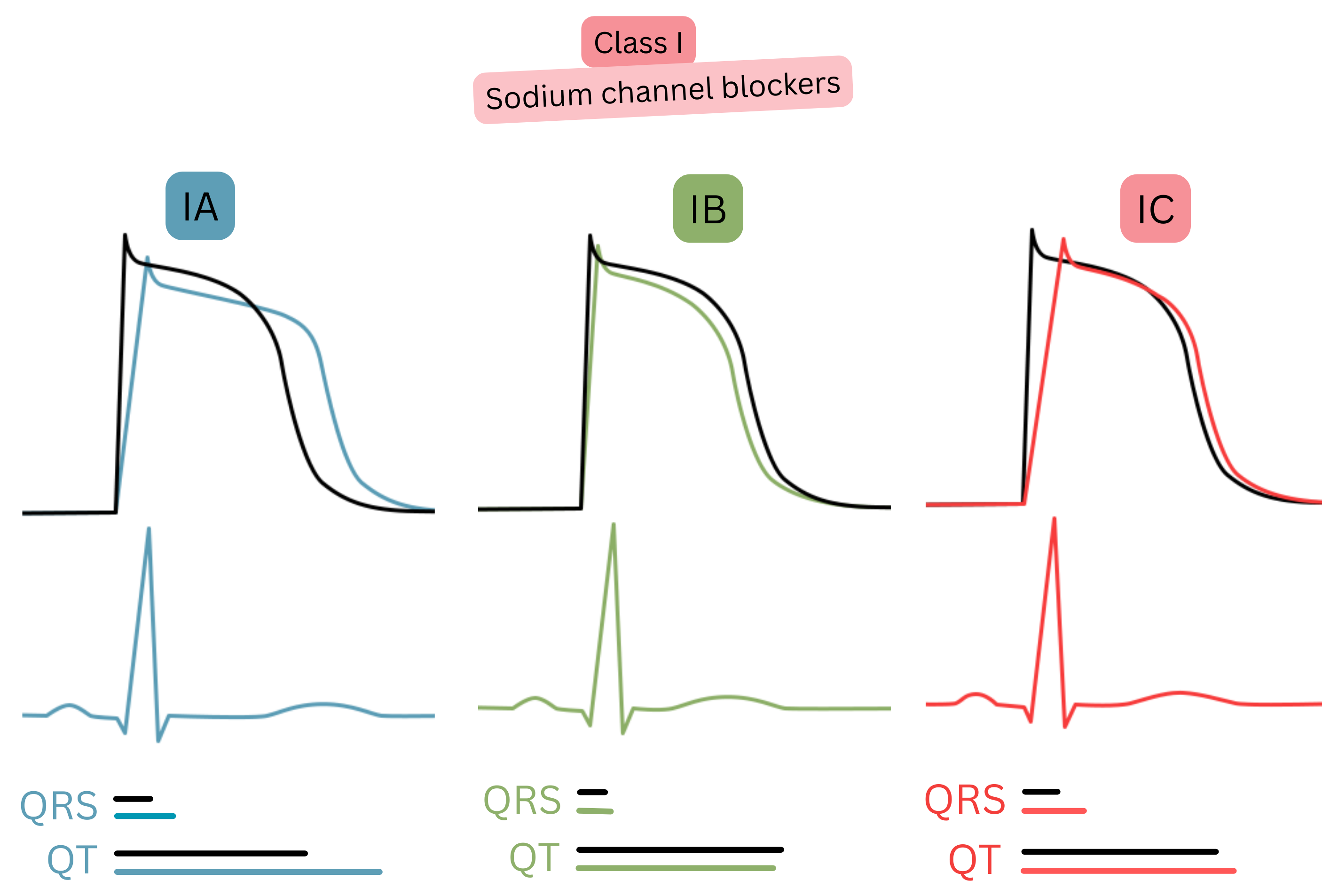 Diagram of the effects of class I antiarrhythmic drugs illustrating differences between subclasses IA, IB, and IC in their impact on the action potential, QRS complex width, and QT interval on ECG.