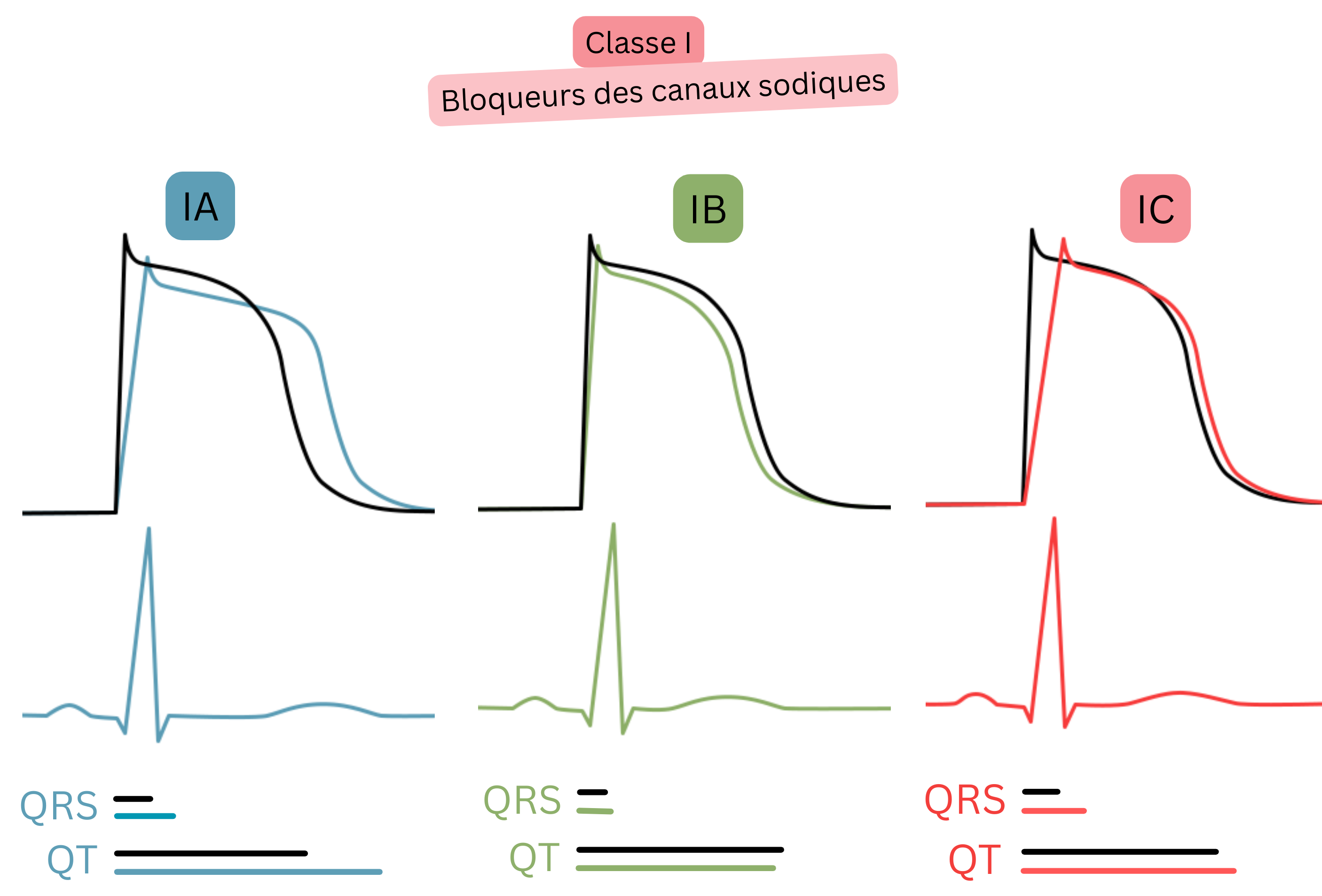Schéma de l’effet des antiarythmiques de classe I illustrant les différences entre les sous-classes IA, IB et IC sur le potentiel d’action, la largeur du complexe QRS et la durée de l’intervalle QT à l’ECG.