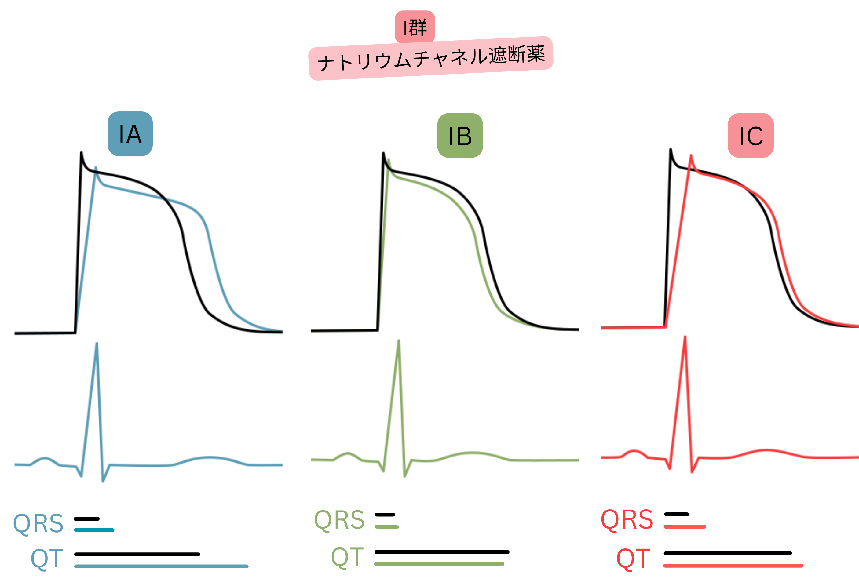 I群抗不整脈薬の作用を示す模式図で、IA、IB、IC各サブクラスによる活動電位、QRS幅、QT間隔への影響の違いを示す。