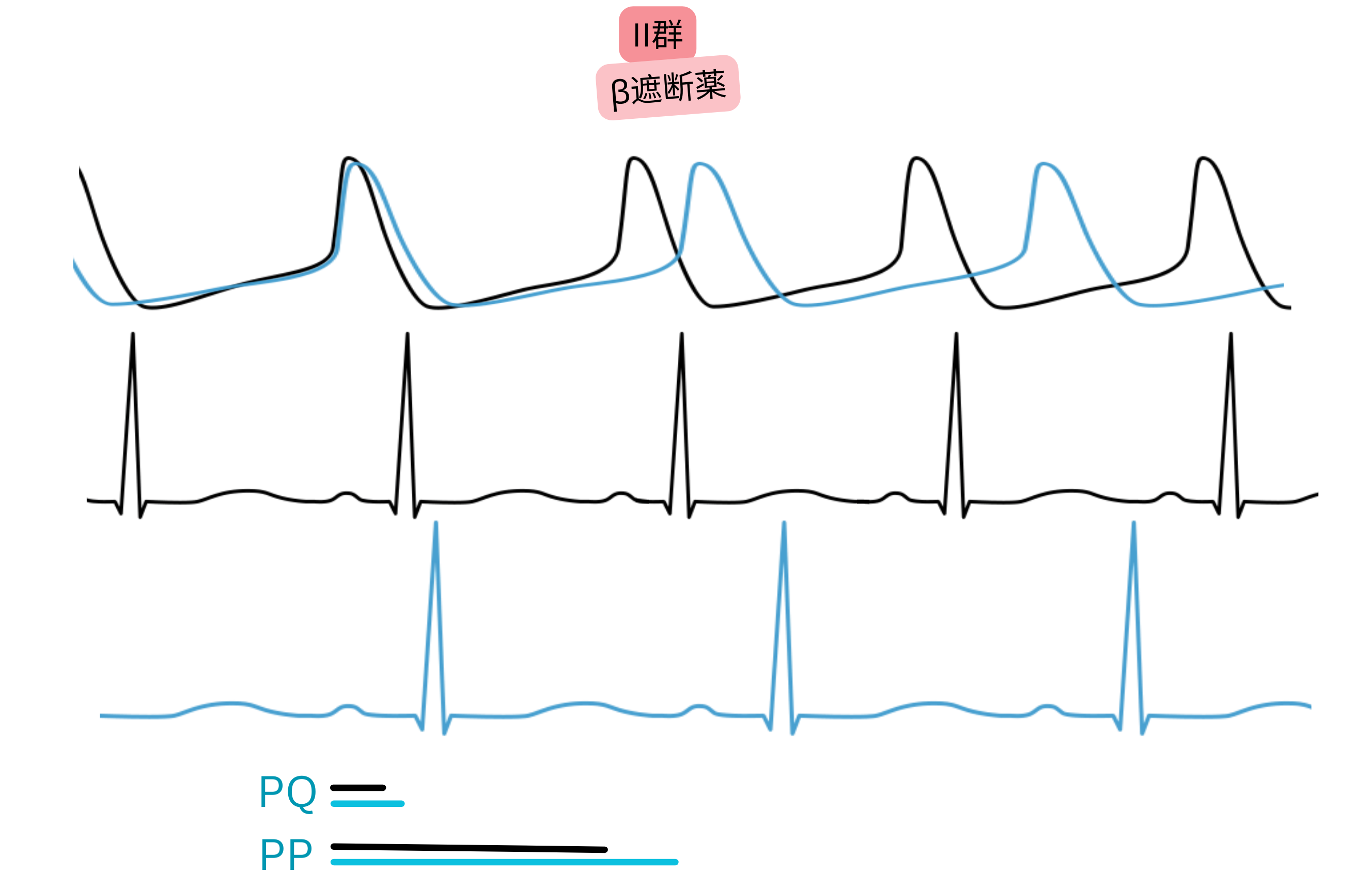 II群抗不整脈薬であるβ遮断薬の作用を示す模式図で、交感神経活動の抑制により洞調律が遅延し、心電図のPPおよびPQ間隔が延長することを示す。