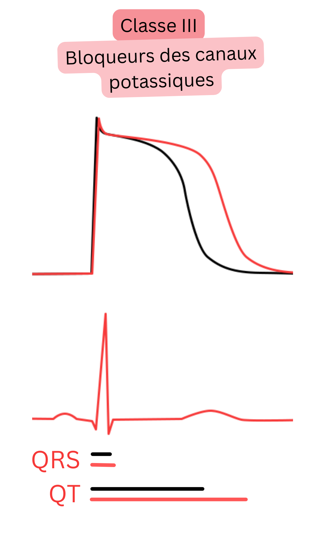Schéma de l’effet des antiarythmiques de classe III — inhibiteurs des canaux potassiques — illustrant l’allongement de la repolarisation du potentiel d’action et de l’intervalle QT à l’ECG, avec une durée du complexe QRS inchangée.